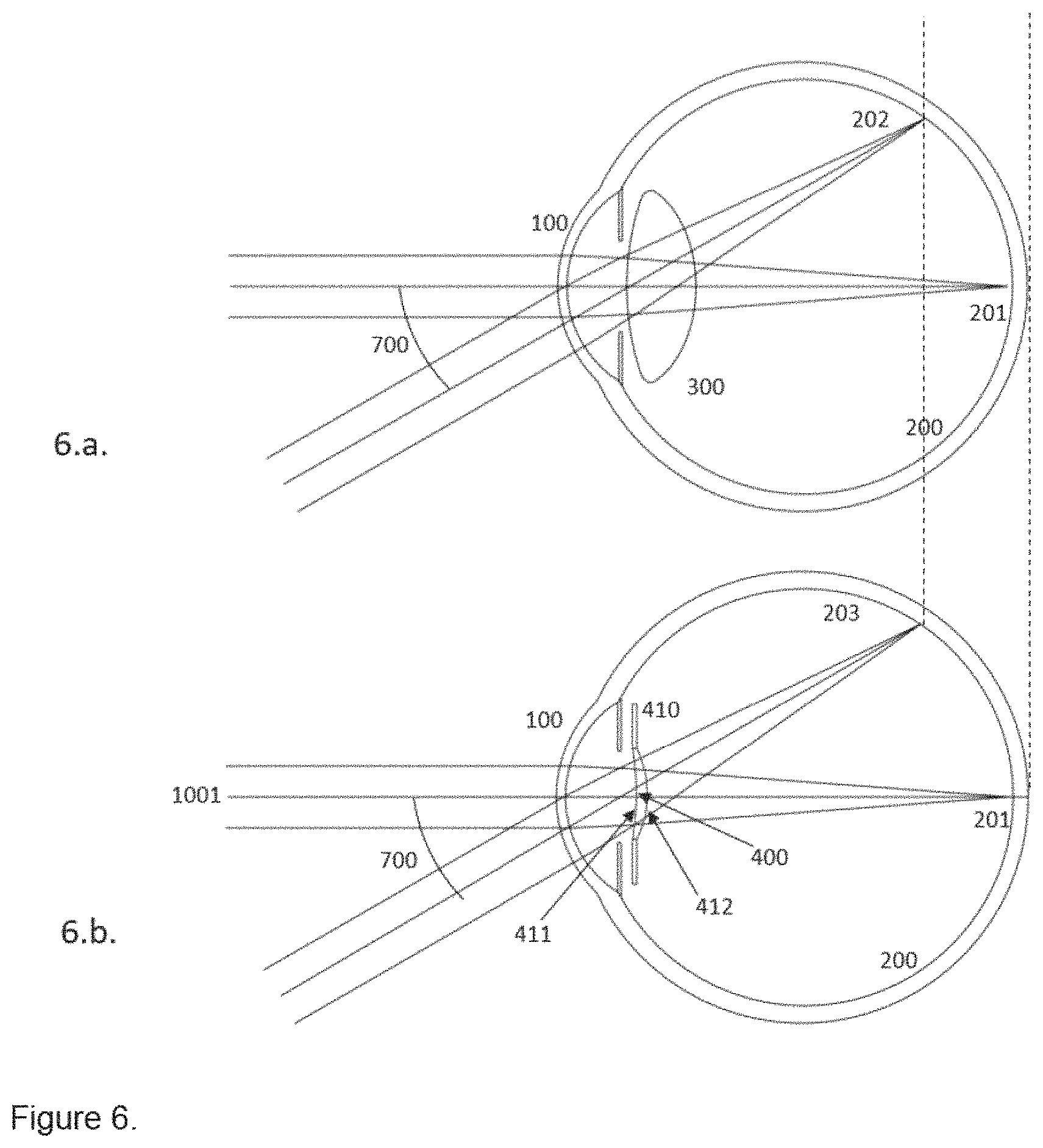 Patent US11771551 Figure 6 – Method to design and manufacture an intraocular lens