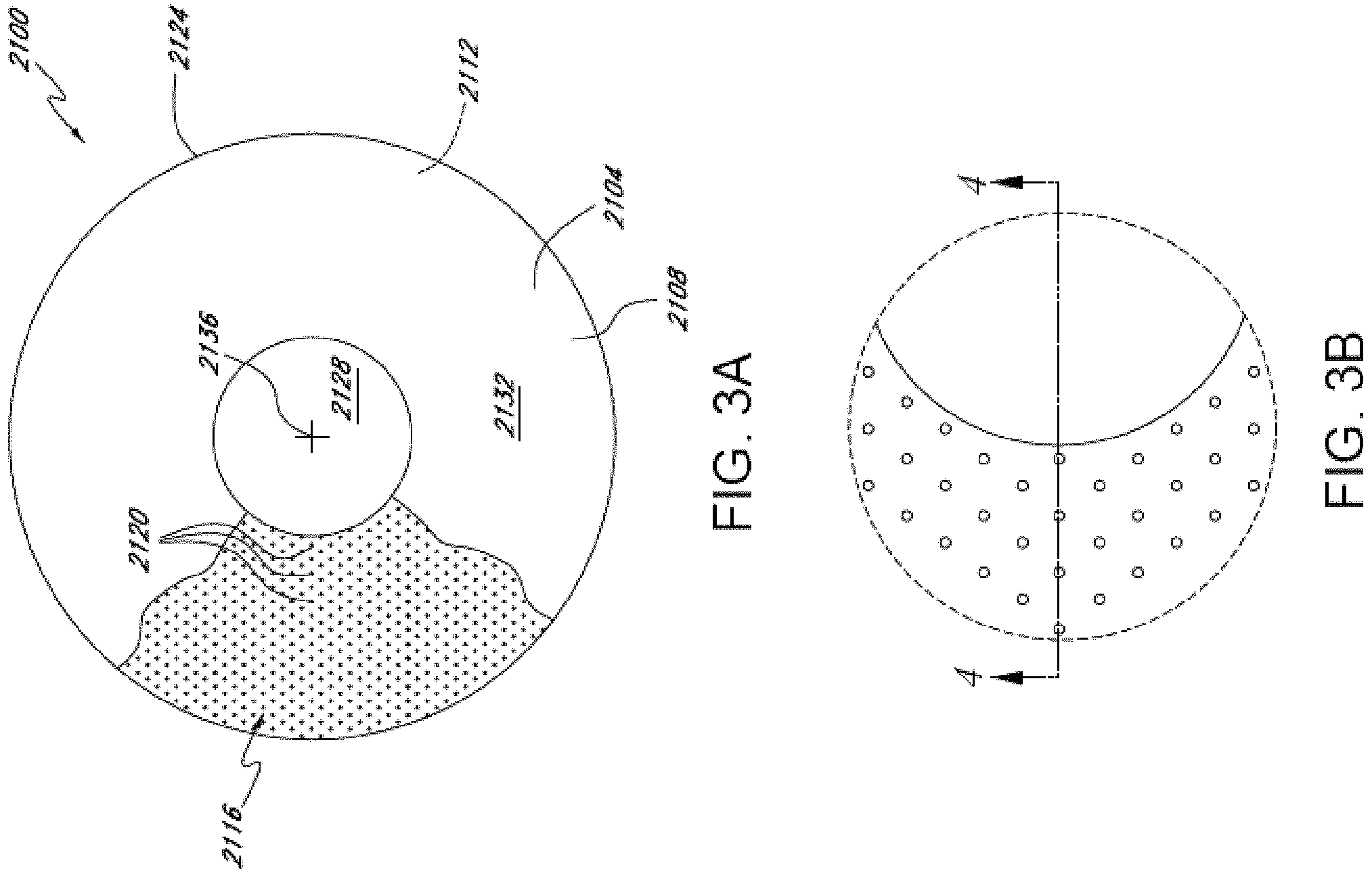 Patent US11771552 Figure 3 – In situ adjustable optical mask