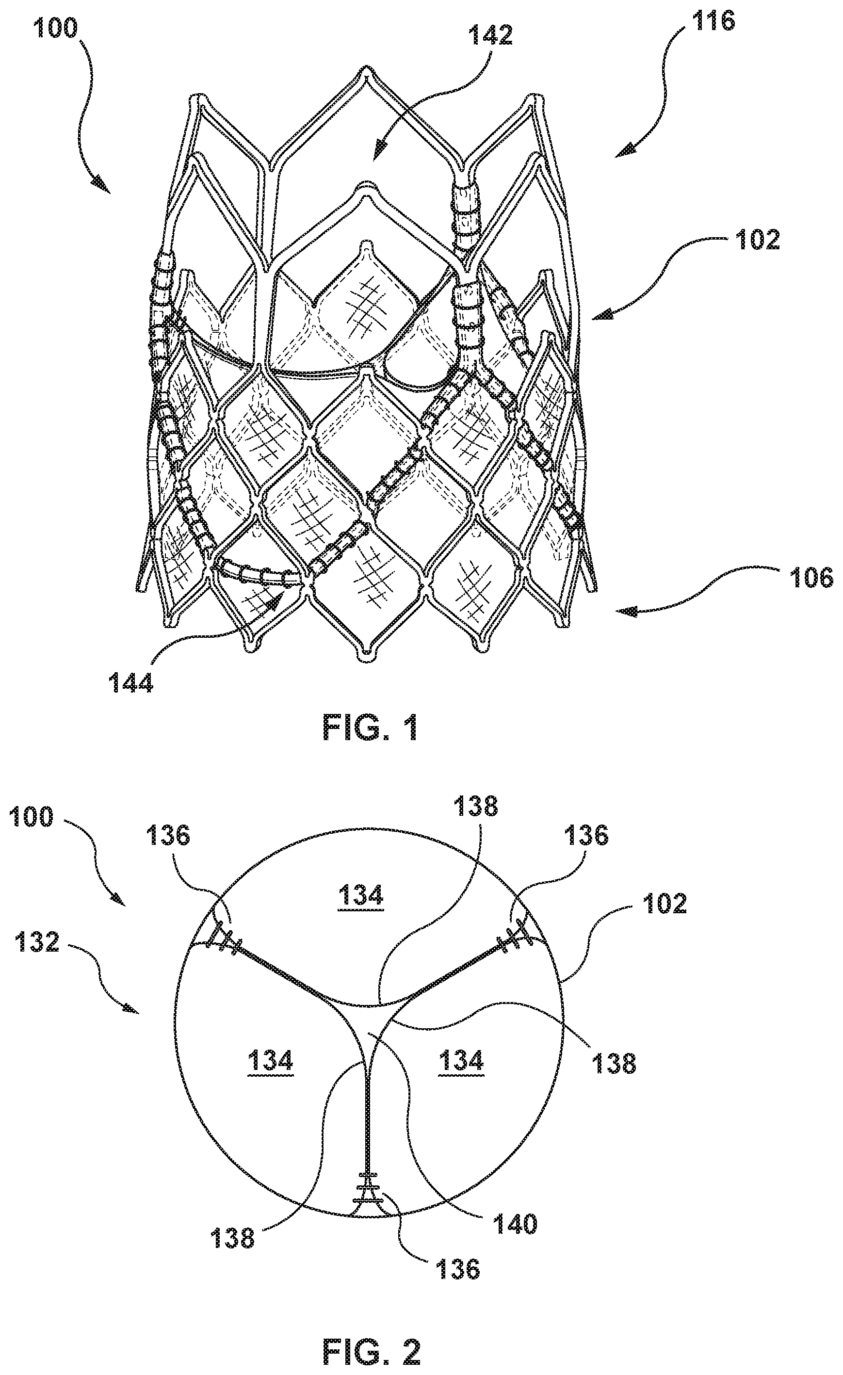 Patent US11771554 Figure 1 – Supra annular tapered balloon expandable stent for transcatheter implantation of a cardiac valve prosthesis