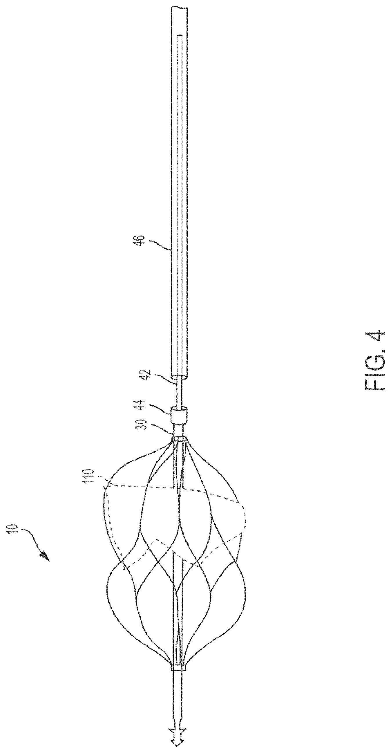 Patent US11771555 Figure 5 – Retrievable self-expanding non-thrombogenic low-profile percutaneous atrioventricular valve prosthesis