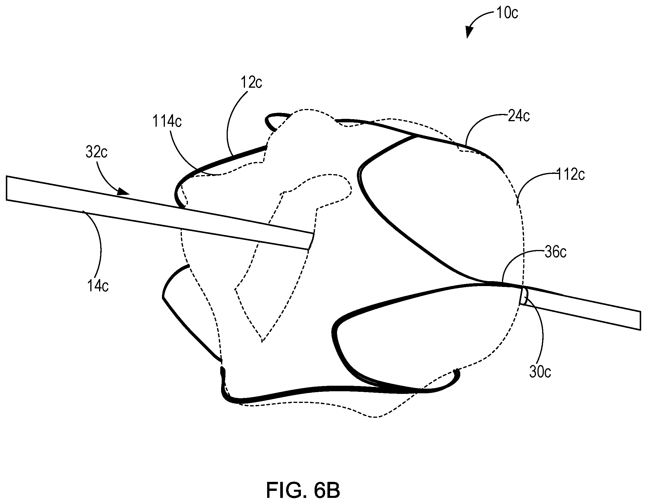 Patent US11771555 Figure 9 – Retrievable self-expanding non-thrombogenic low-profile percutaneous atrioventricular valve prosthesis