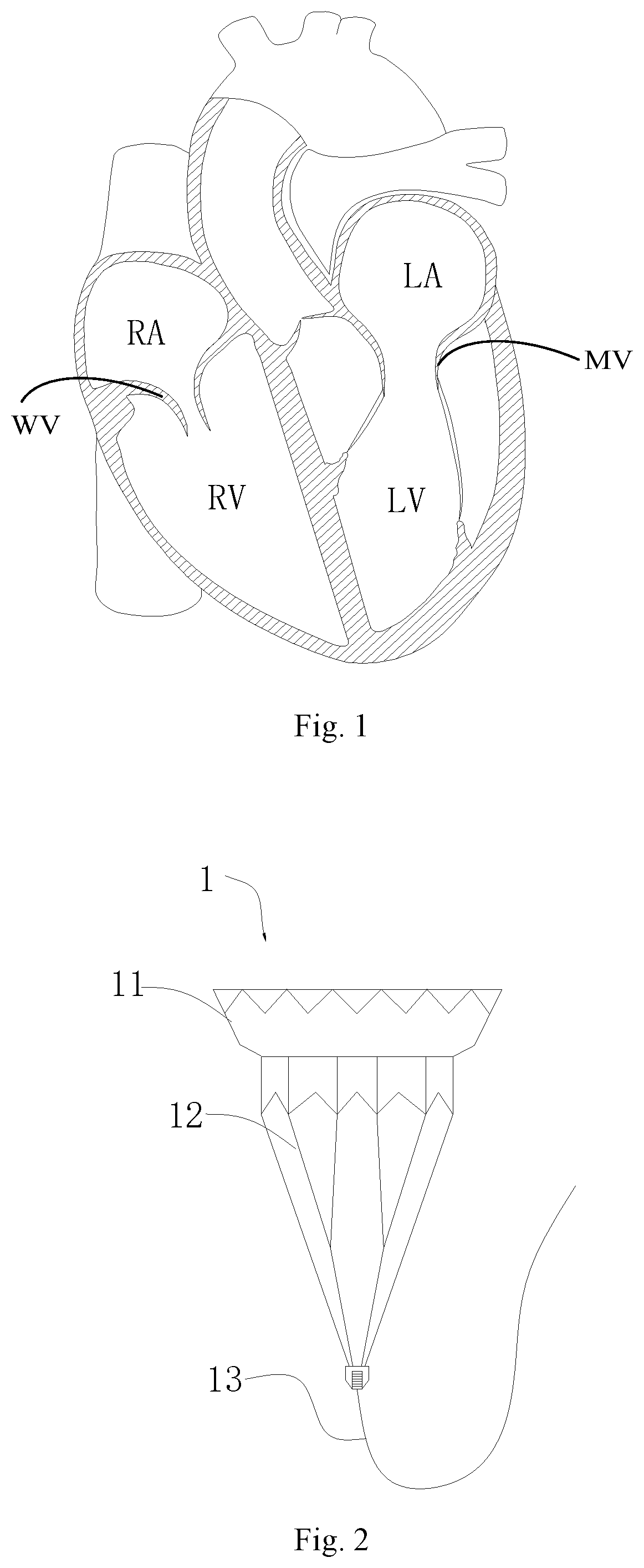 Patent US11771556 — Intervention guidance device — Figure 1