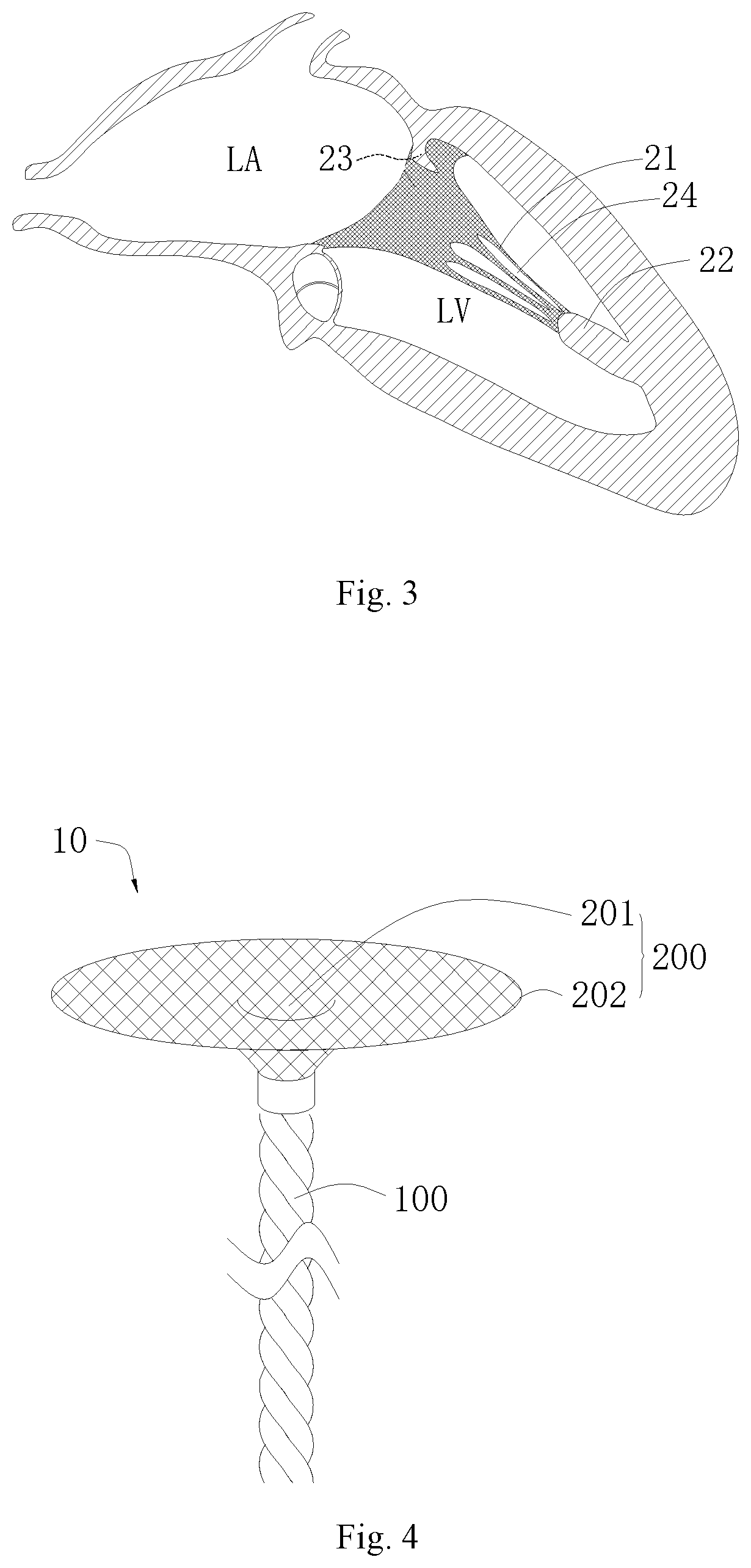 Patent US11771556 Figure 2 – Intervention guidance device