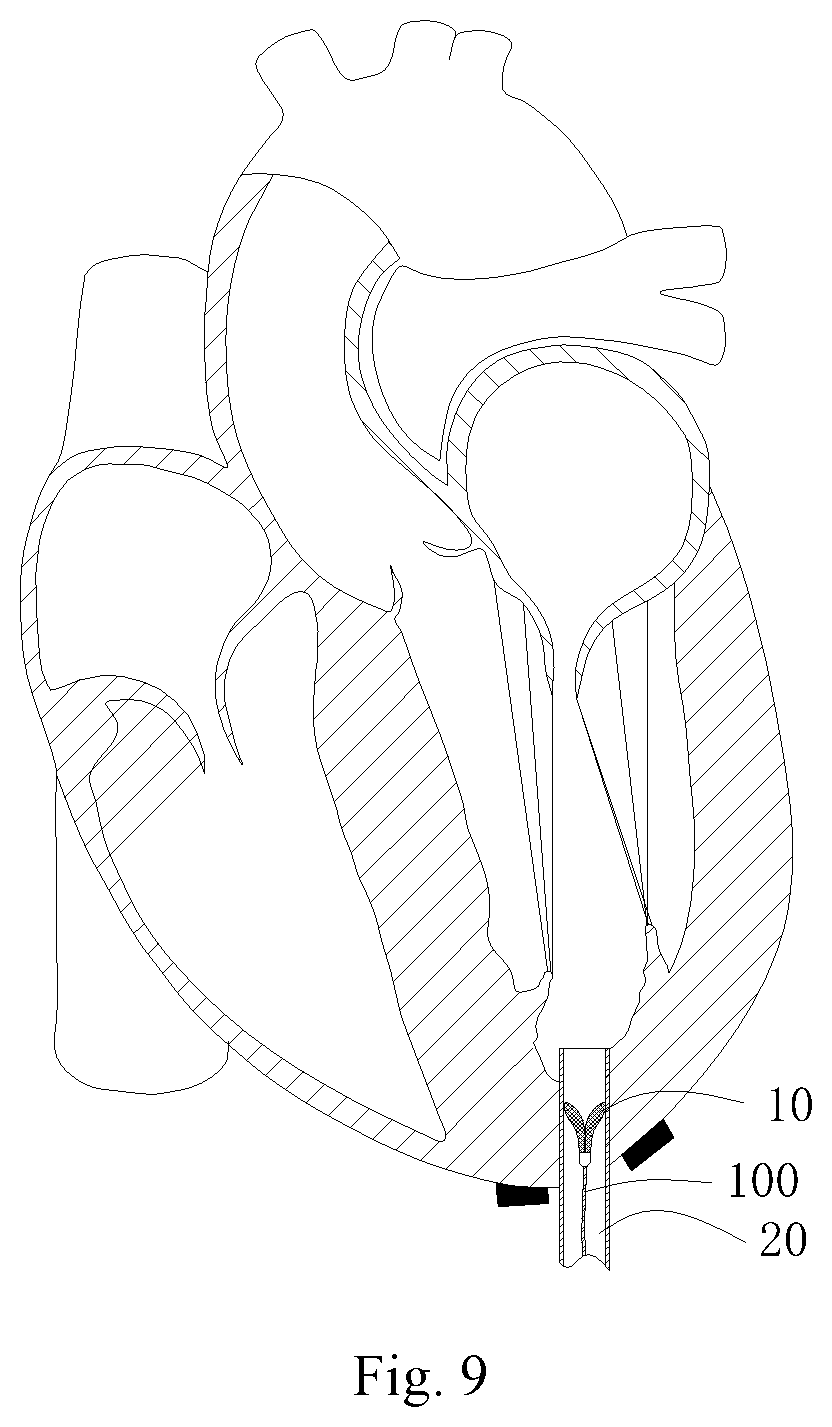 Patent US11771556 Figure 5 – Intervention guidance device