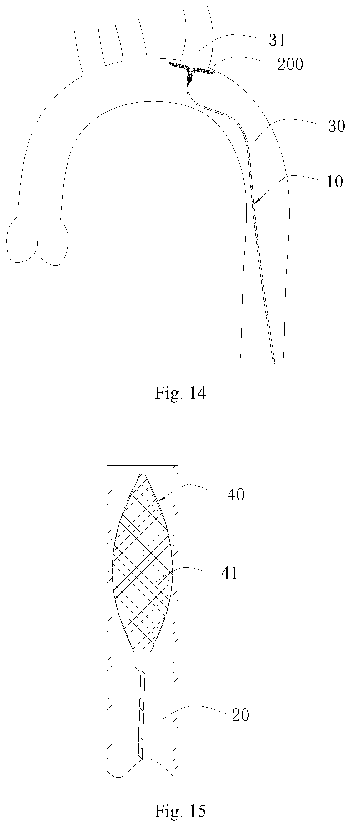 Patent US11771556 Figure 9 – Intervention guidance device