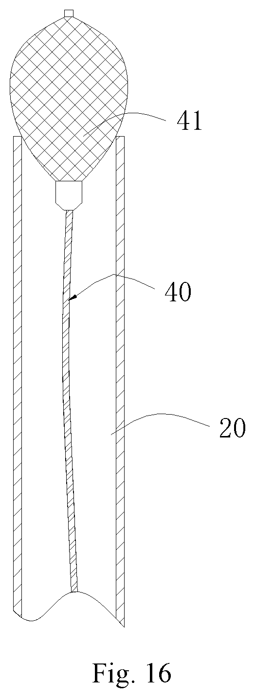 Patent US11771556 Figure 10 – Intervention guidance device