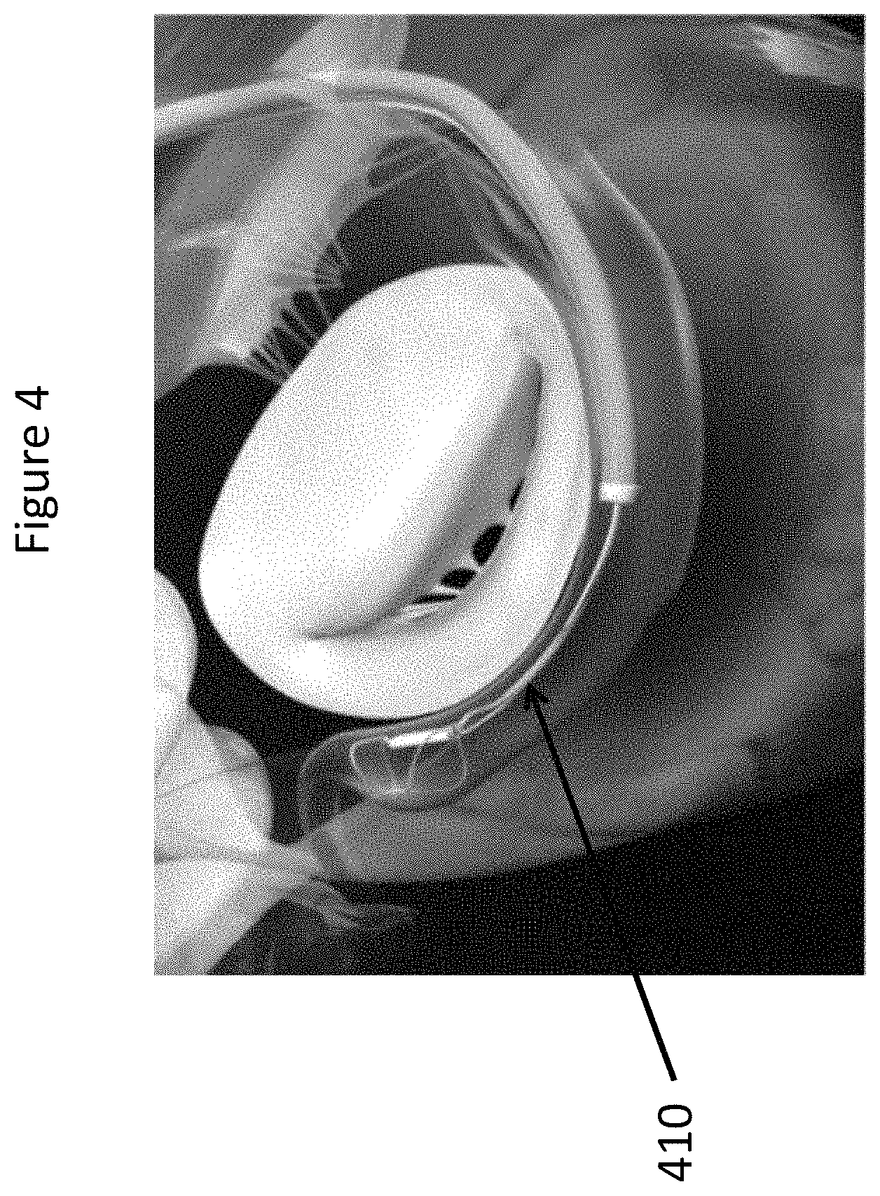 Patent US11771557 Figure 4 – Apparatus and method to reshape geometry of diseased heart valve
