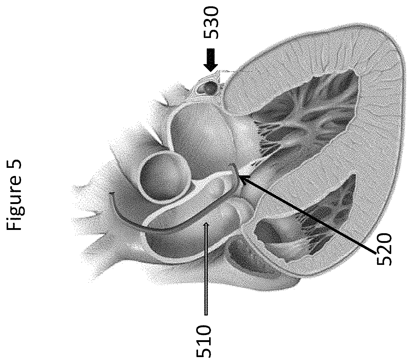 Patent US11771557 Figure 5 – Apparatus and method to reshape geometry of diseased heart valve