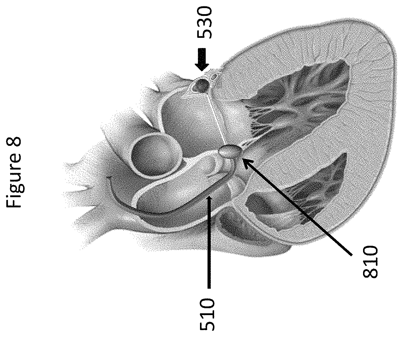 Patent US11771557 Figure 8 – Apparatus and method to reshape geometry of diseased heart valve