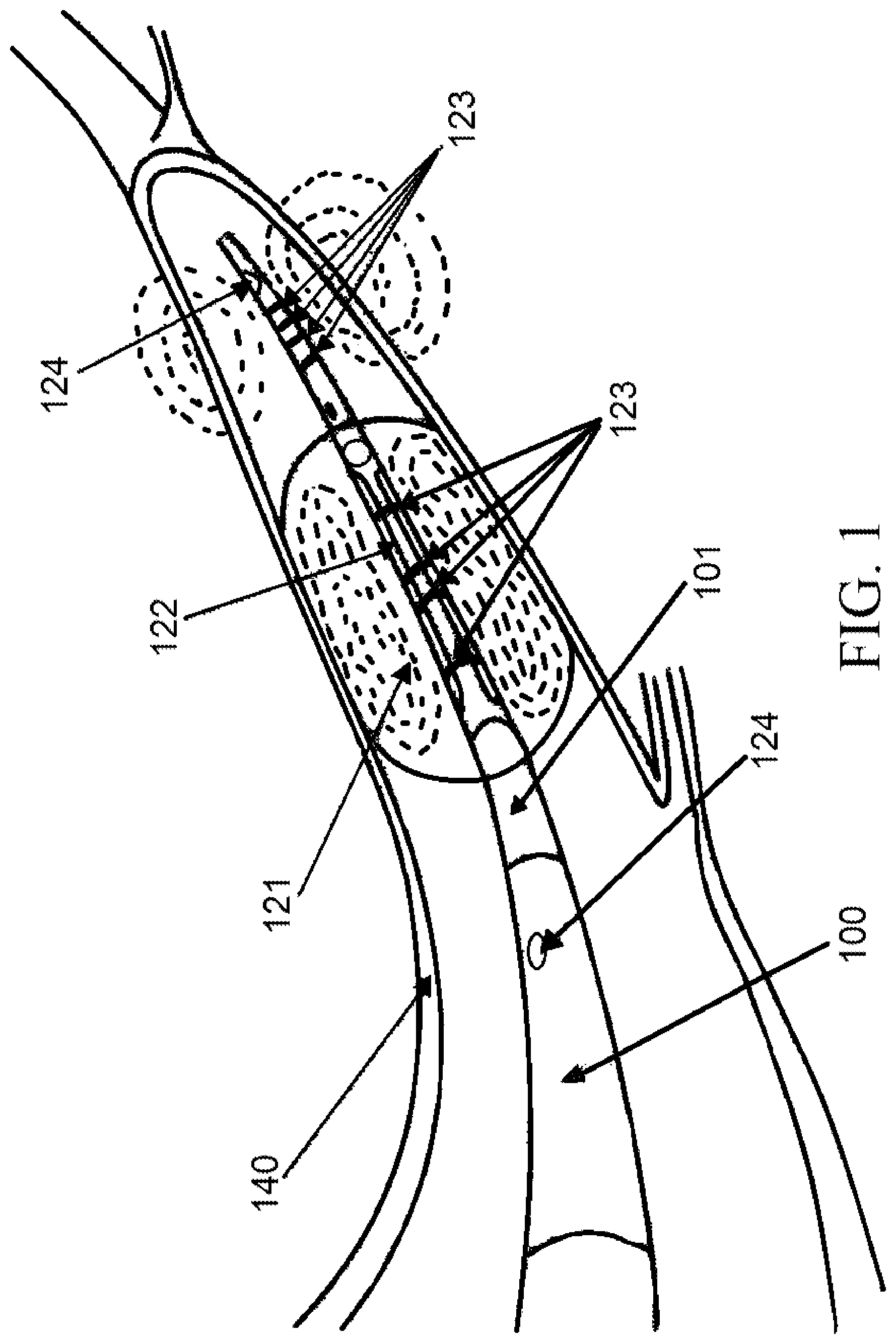 Patent US11771558 Figure 1 – Devices and methods for controlling blood perfusion pressure along with regional mild hypothermia