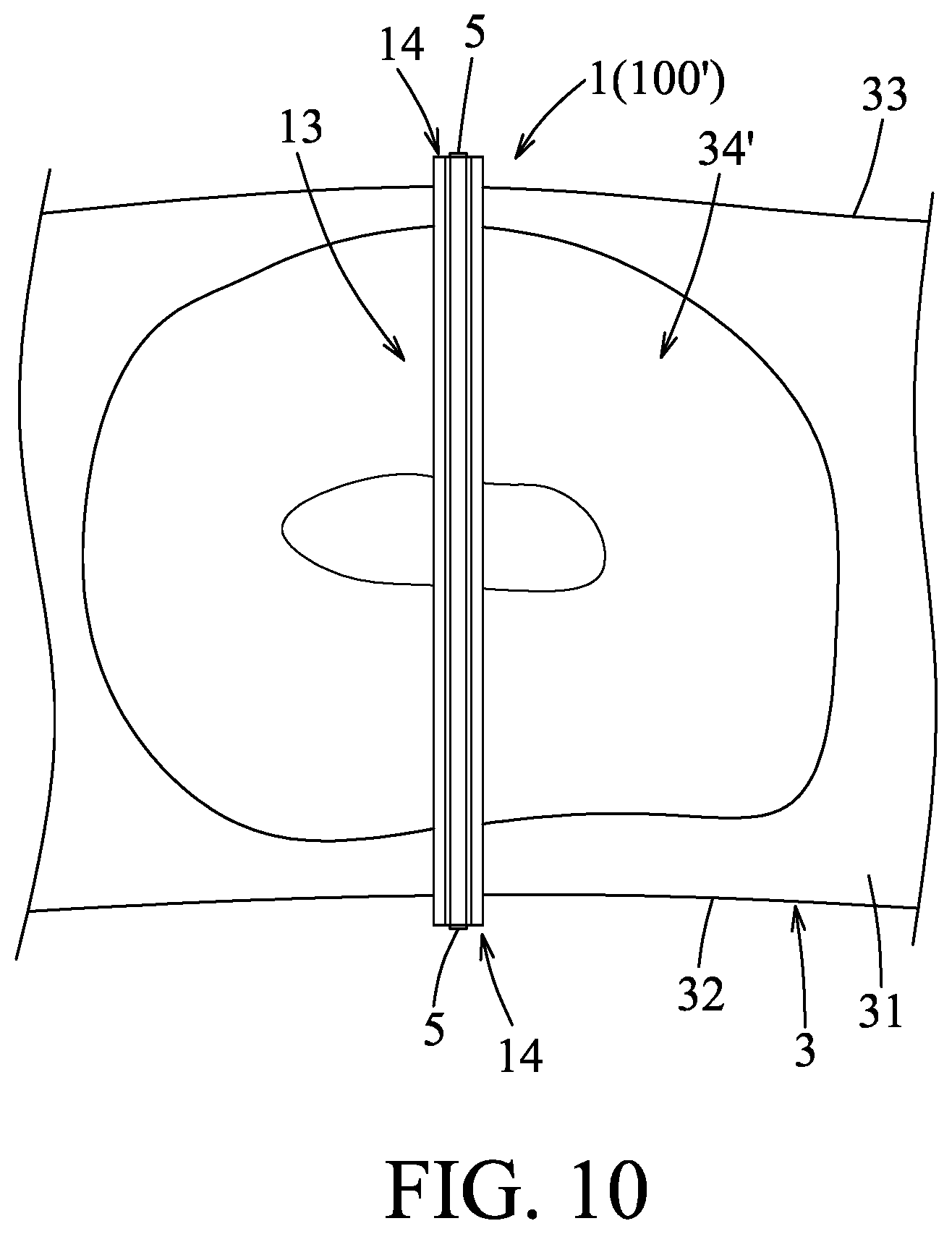 Patent US11771559 Figure 10 – Support device and method of using the same