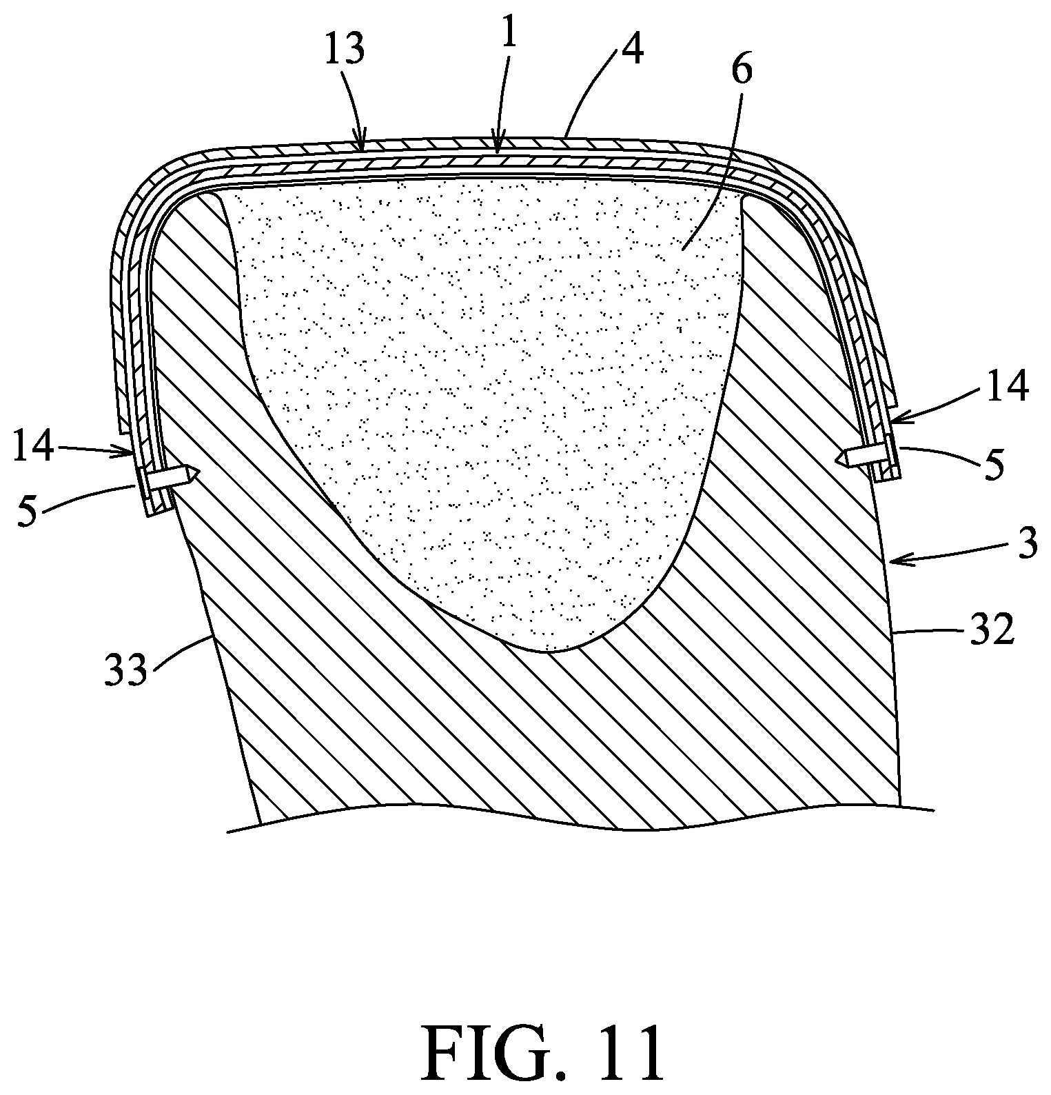 Patent US11771559 Figure 11 – Support device and method of using the same