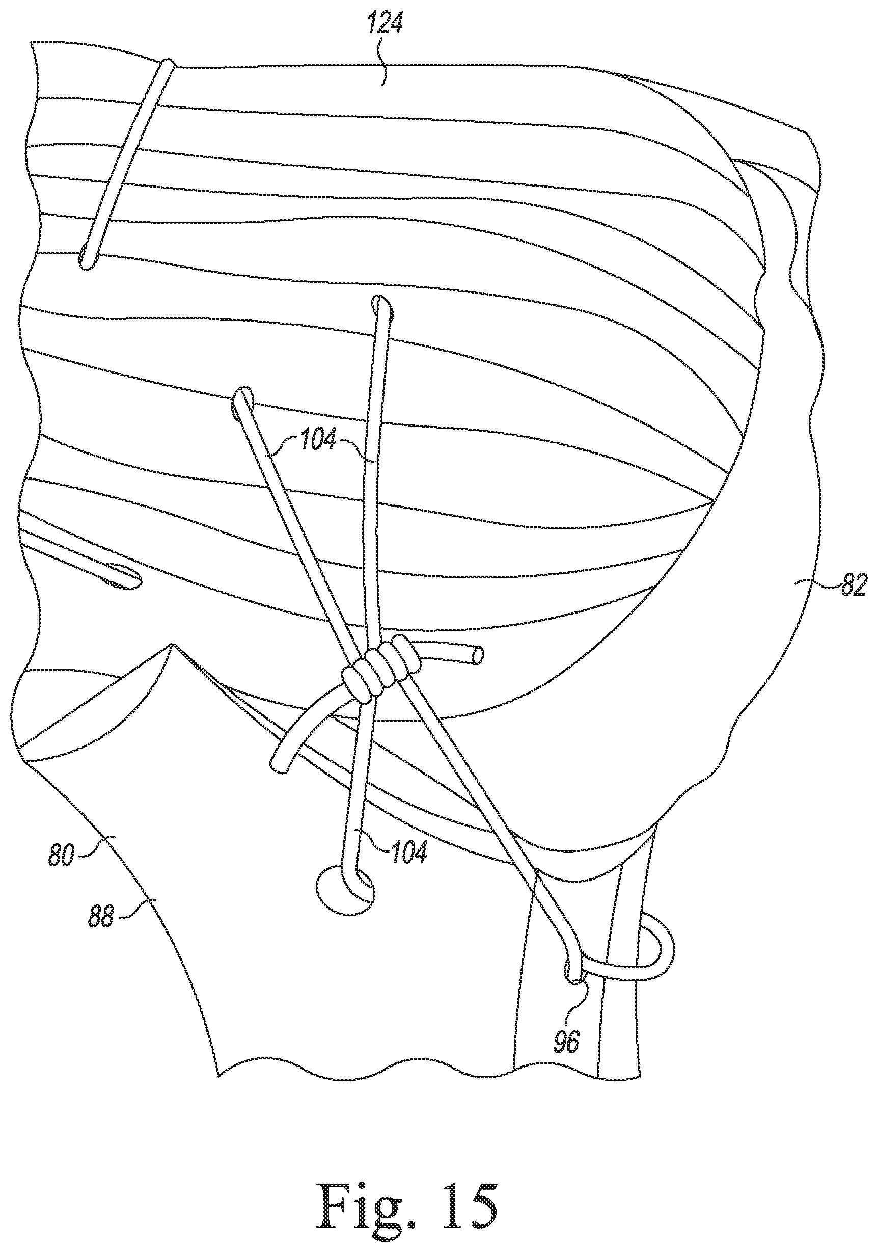 Patent US11771560 Figure 13 – Modular reverse shoulder orthopaedic implant and method of implanting the same