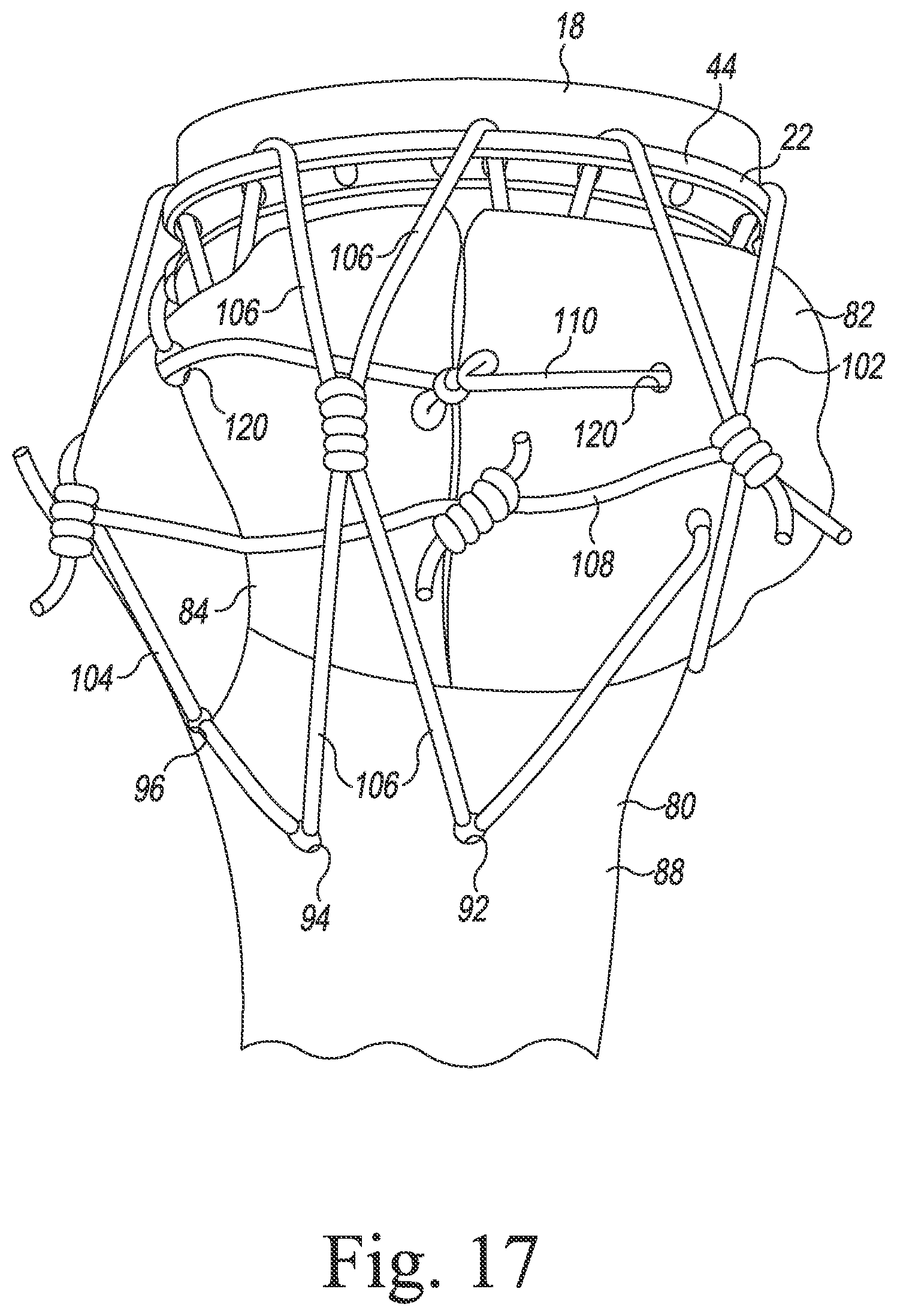 Patent US11771560 Figure 15 – Modular reverse shoulder orthopaedic implant and method of implanting the same