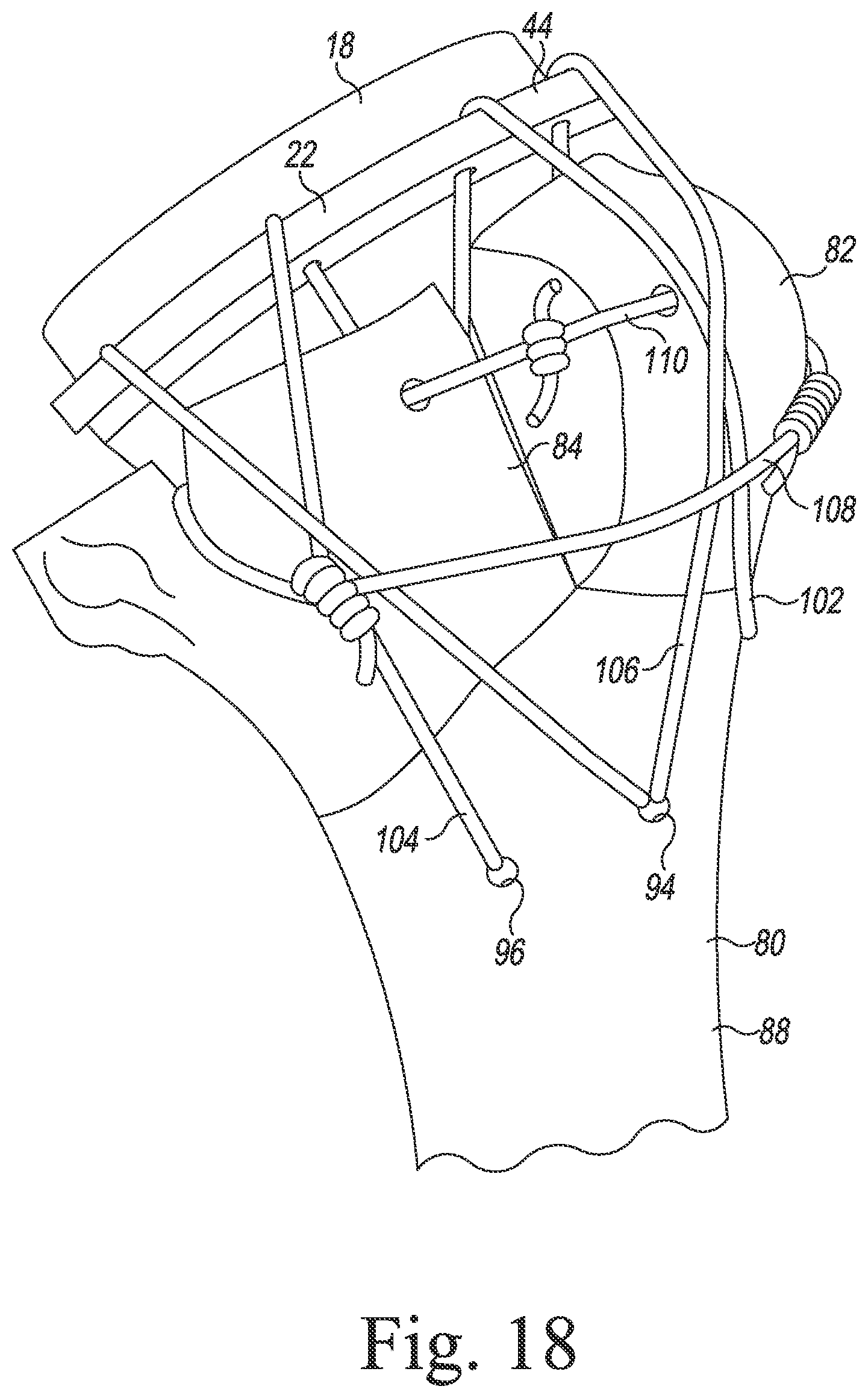 Patent US11771560 Figure 16 – Modular reverse shoulder orthopaedic implant and method of implanting the same