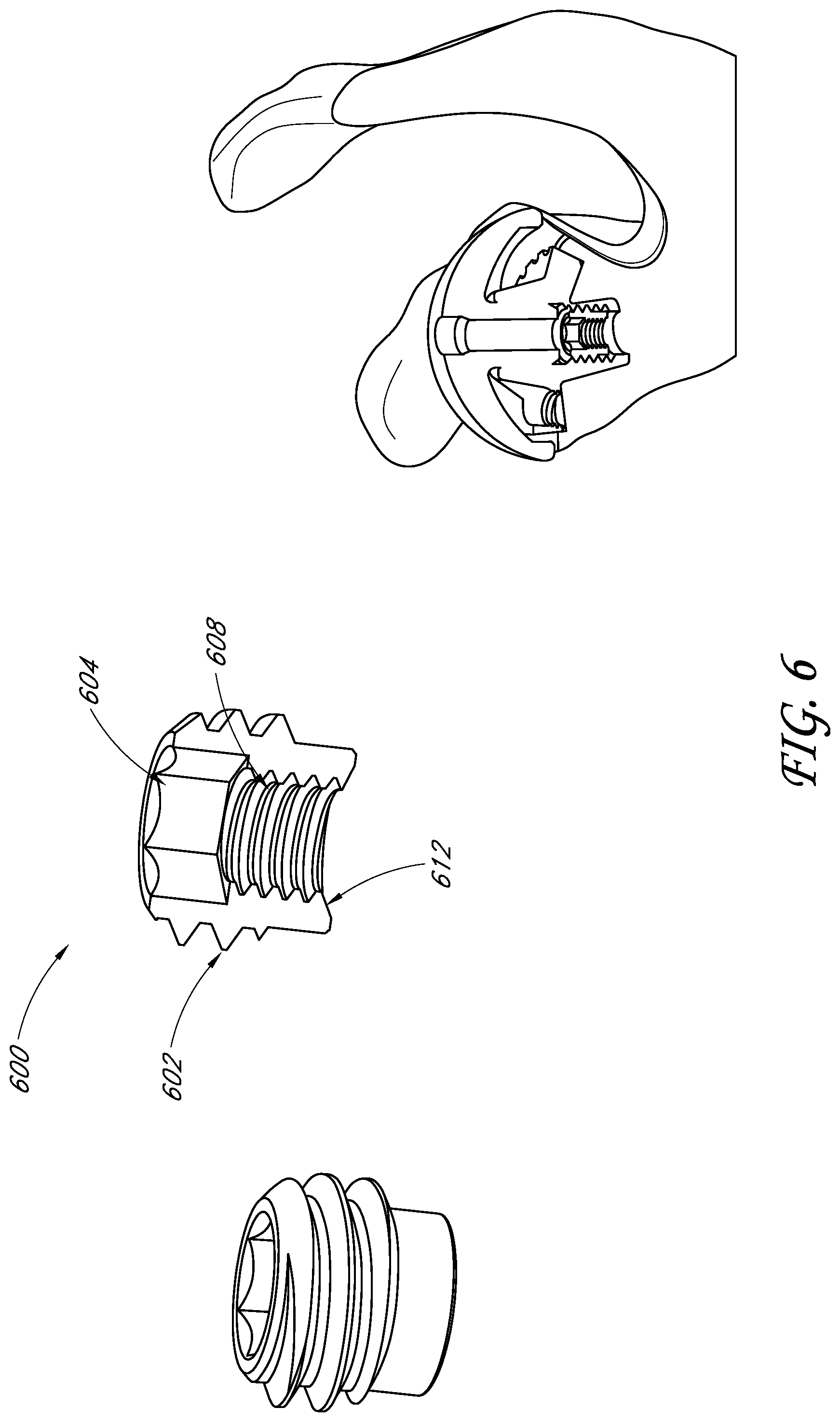 Patent US11771561 Figure 6 – Total reverse shoulder systems and methods