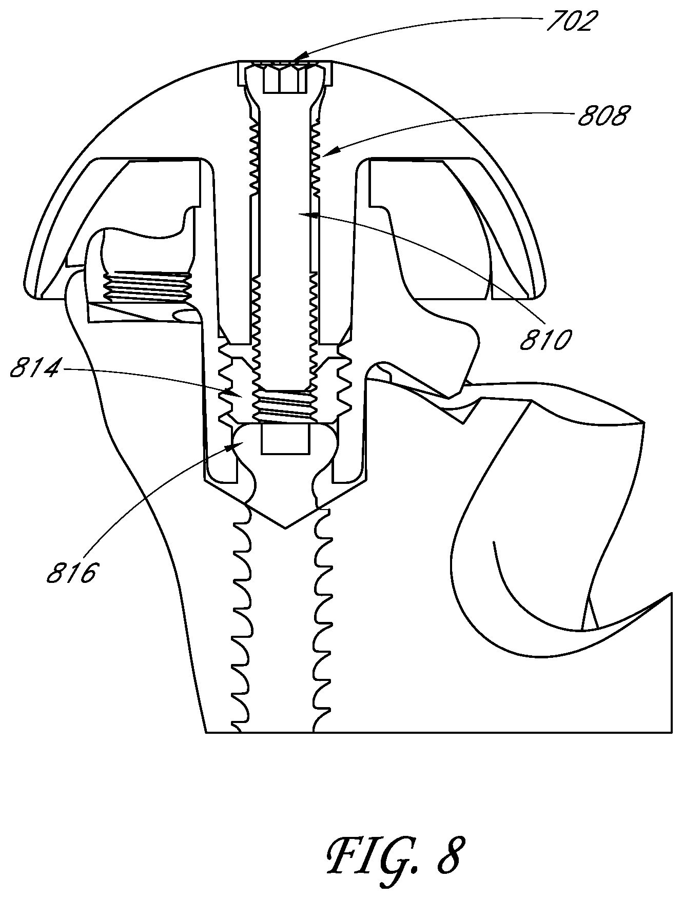 Patent US11771561 Figure 8 – Total reverse shoulder systems and methods