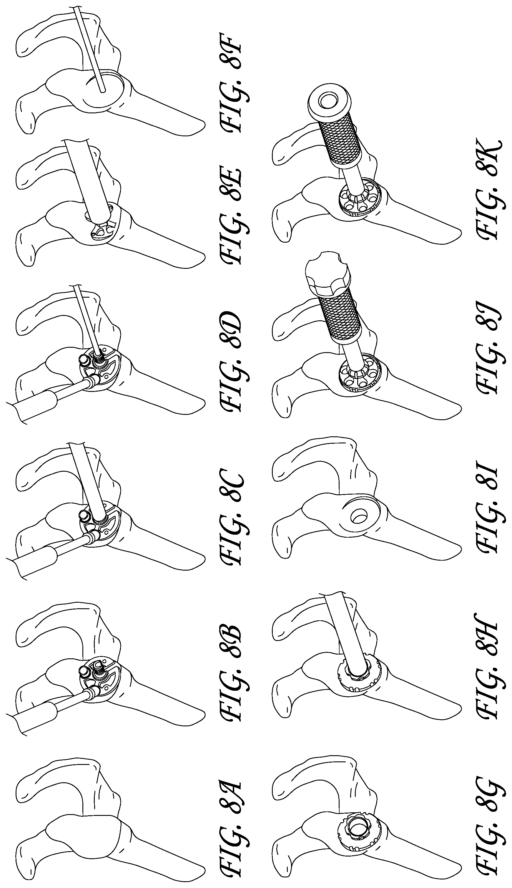 Patent US11771561 Figure 9 – Total reverse shoulder systems and methods