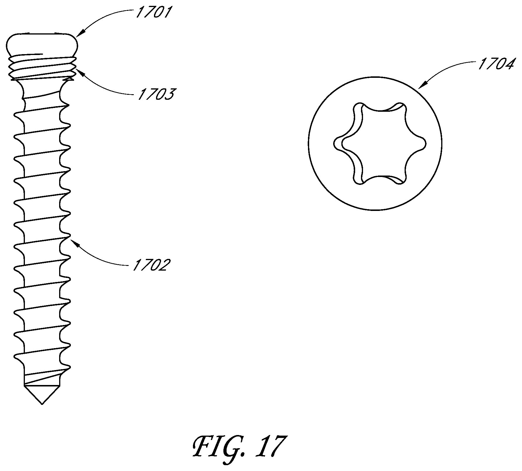 Patent US11771561 Figure 19 – Total reverse shoulder systems and methods