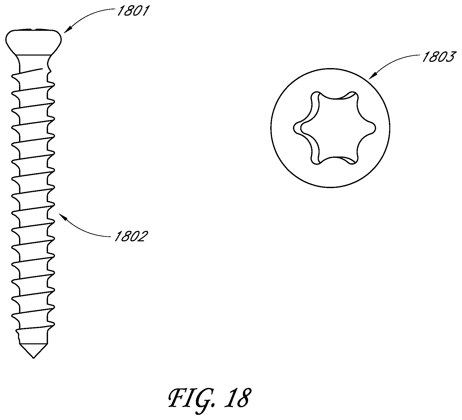 Patent US11771561 Figure 20 – Total reverse shoulder systems and methods