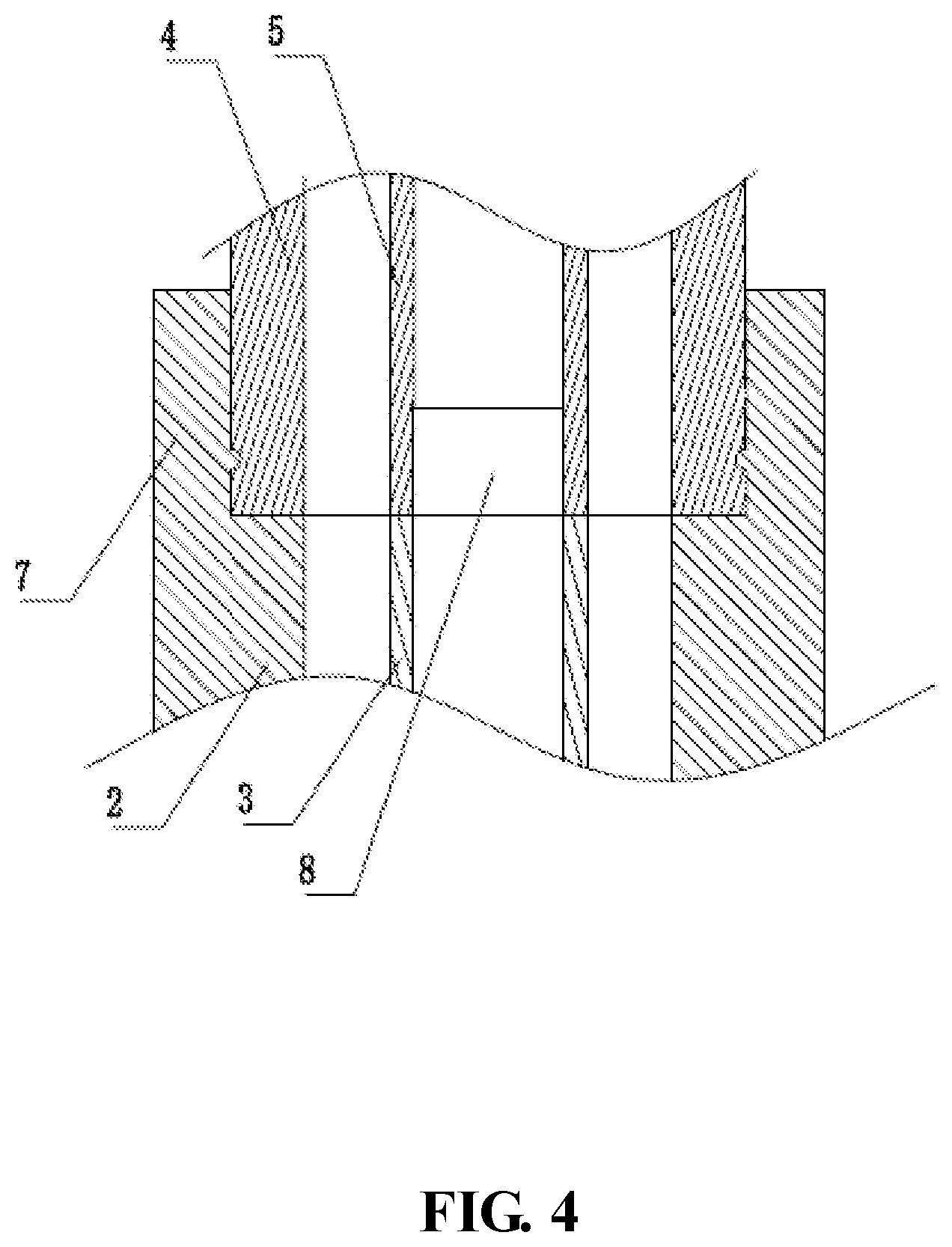 Patent US11771562 Figure 4 – Balloon, medical device and medical procedure for discoplasty