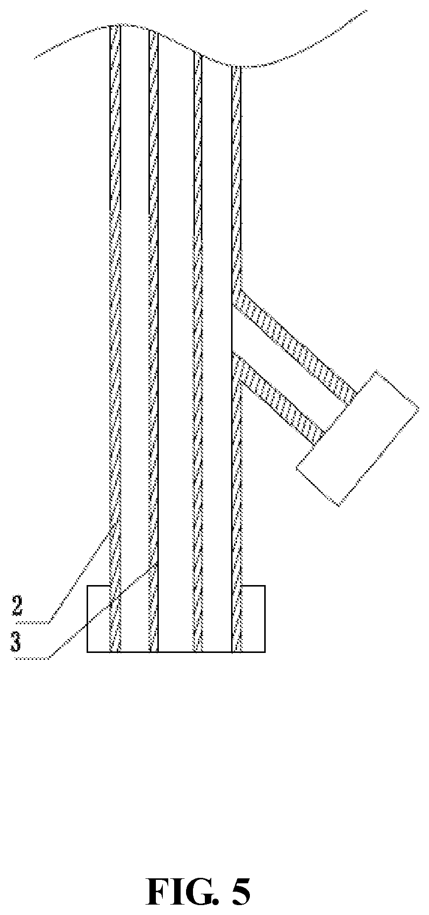 Patent US11771562 Figure 5 – Balloon, medical device and medical procedure for discoplasty