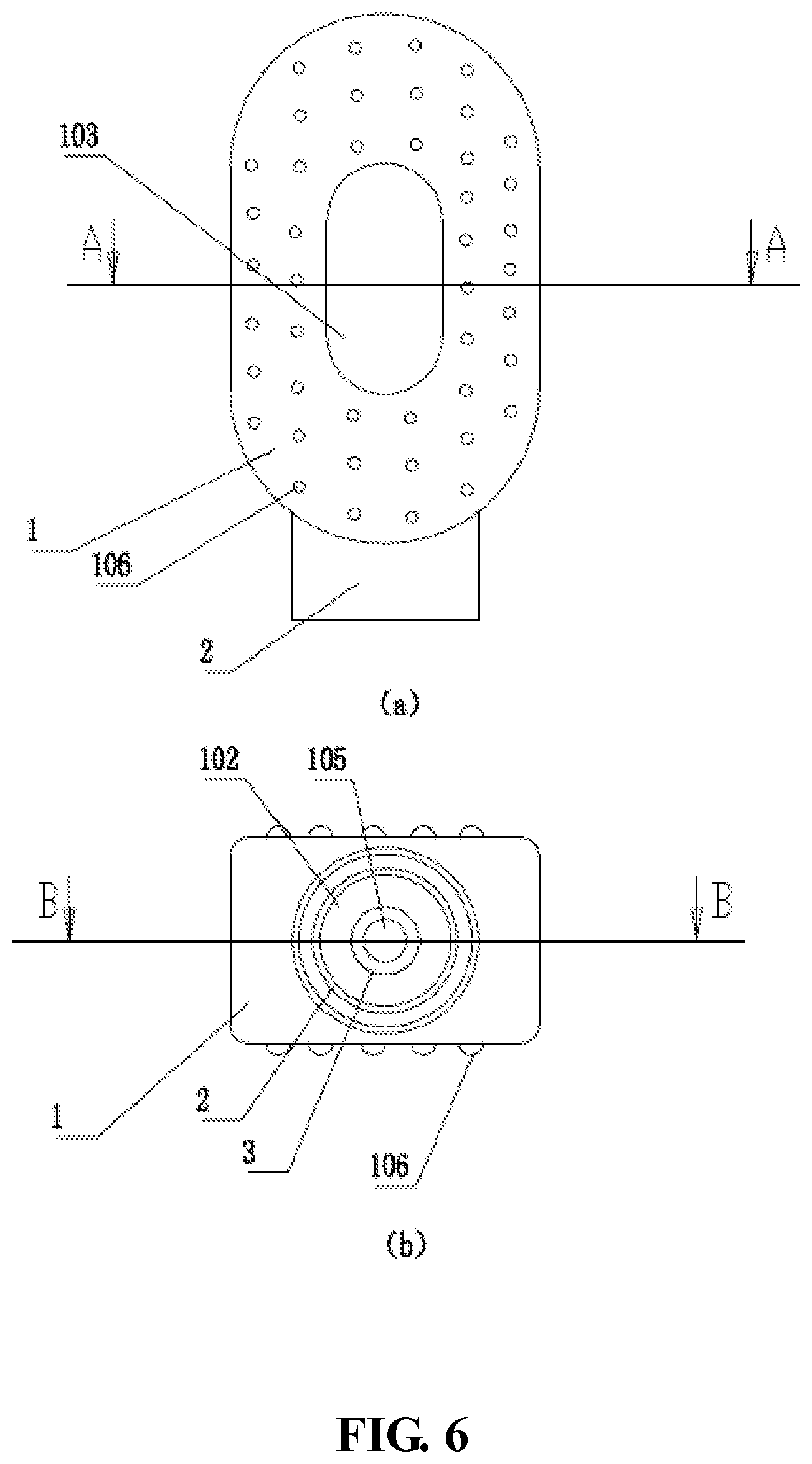 Patent US11771562 Figure 6 – Balloon, medical device and medical procedure for discoplasty