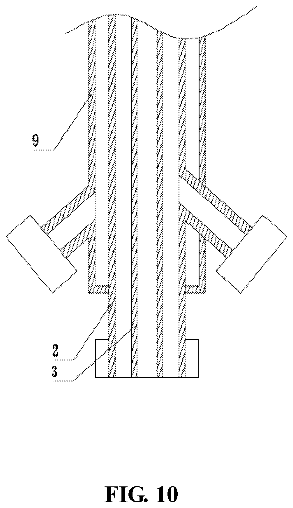 Patent US11771562 Figure 10 – Balloon, medical device and medical procedure for discoplasty