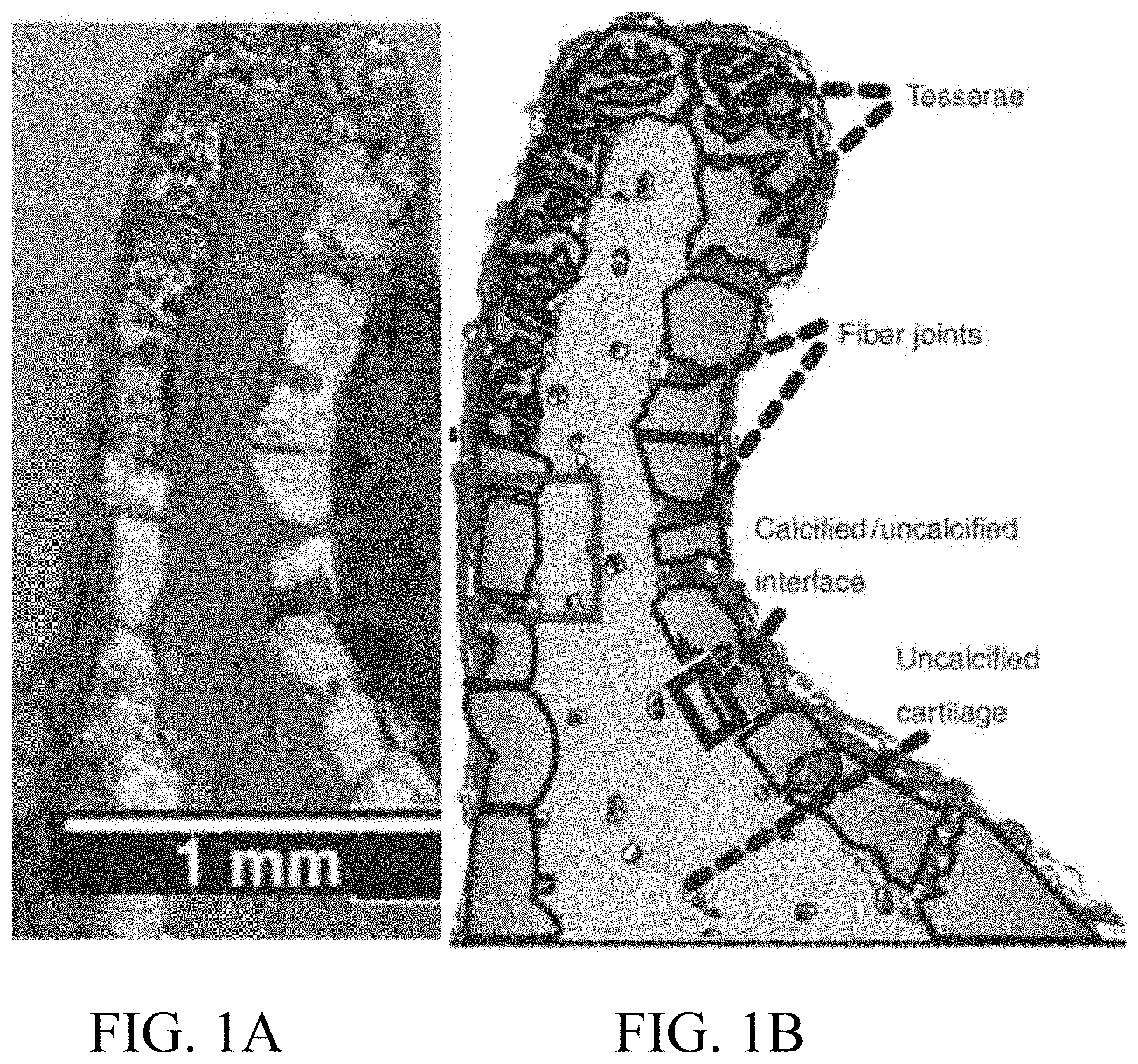 Patent US11771563 Figure 1 – Artificial tessellated implants, and systems and methods of making and using same