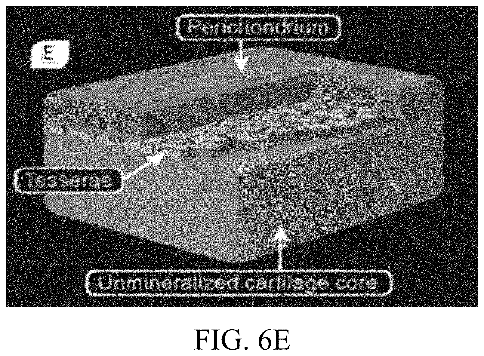 Patent US11771563 Figure 11 – Artificial tessellated implants, and systems and methods of making and using same