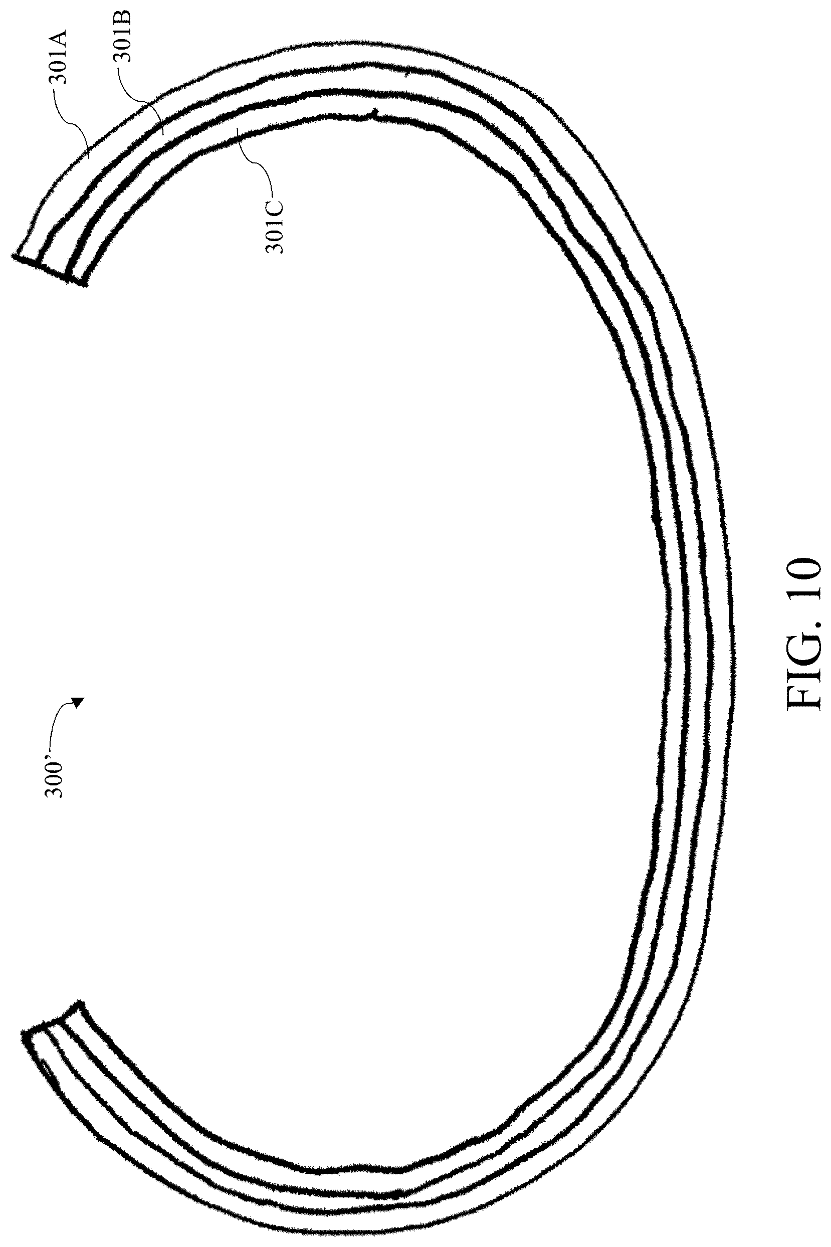 Patent US11771563 Figure 15 – Artificial tessellated implants, and systems and methods of making and using same