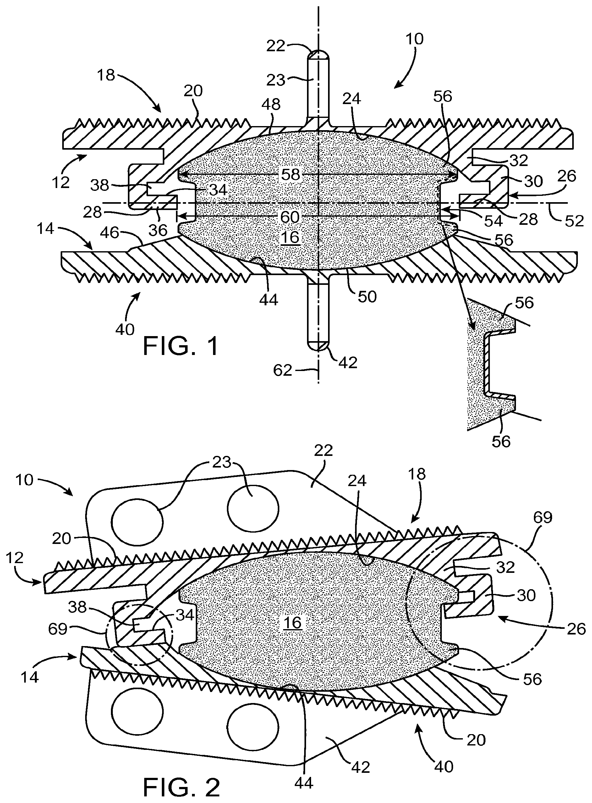 Patent US11771565 Figure 1 – Prosthetic disc for intervertebral insertion