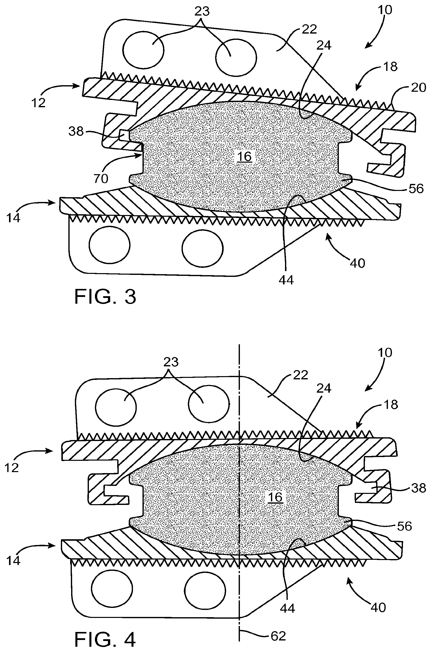 Patent US11771565 Figure 2 – Prosthetic disc for intervertebral insertion