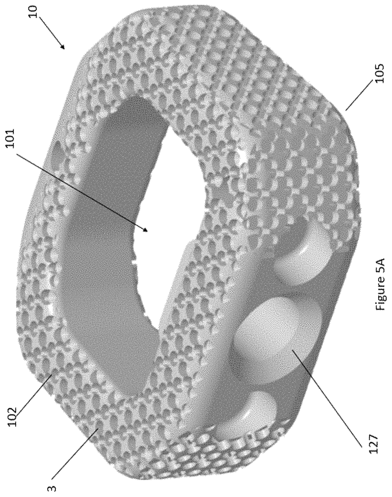 Patent US11771566 Figure 10 – Porous spinal implant