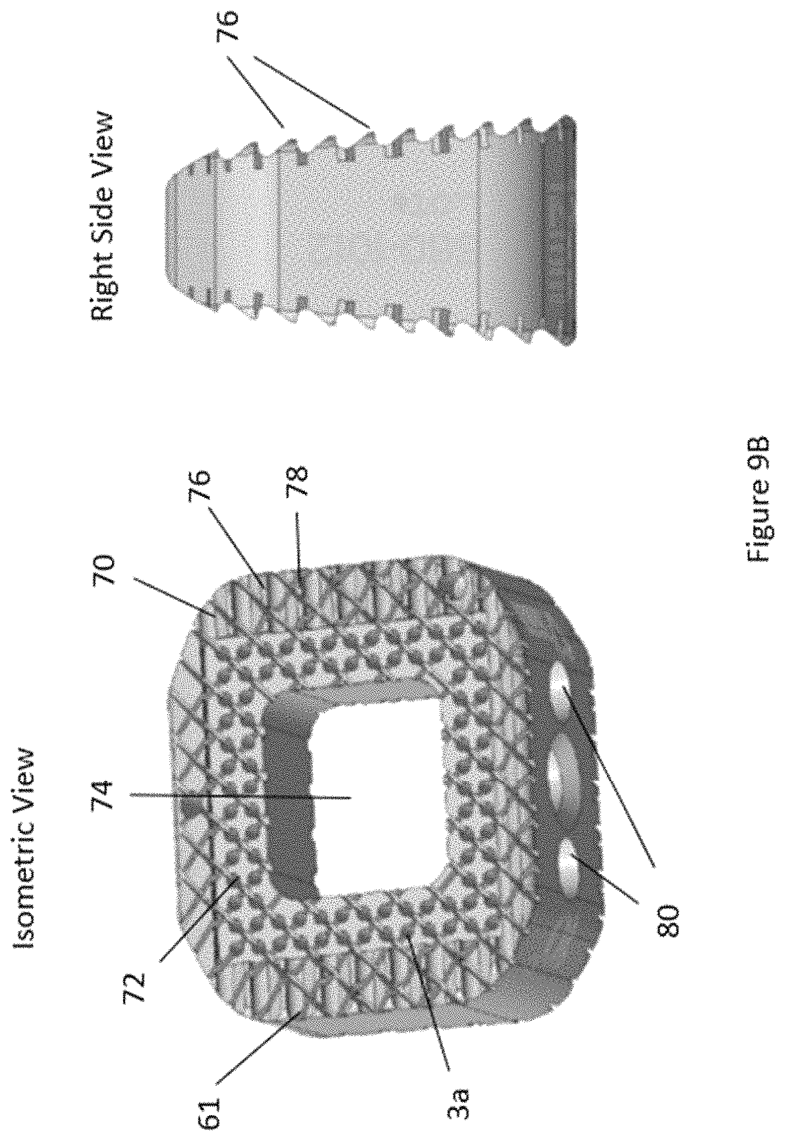 Patent US11771566 Figure 16 – Porous spinal implant