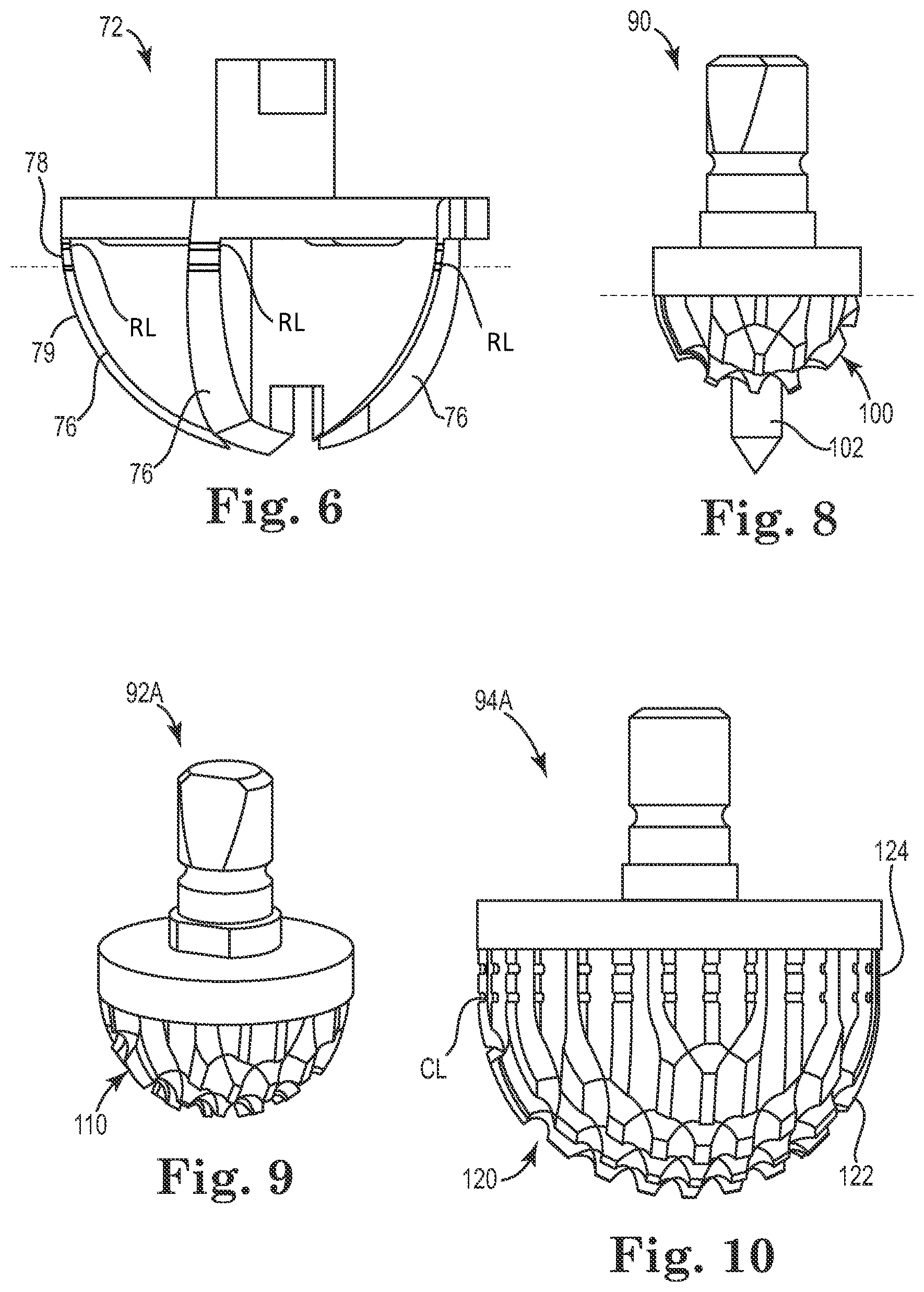 Patent US11771568 Figure 4 – Intra-articular joint replacement and method