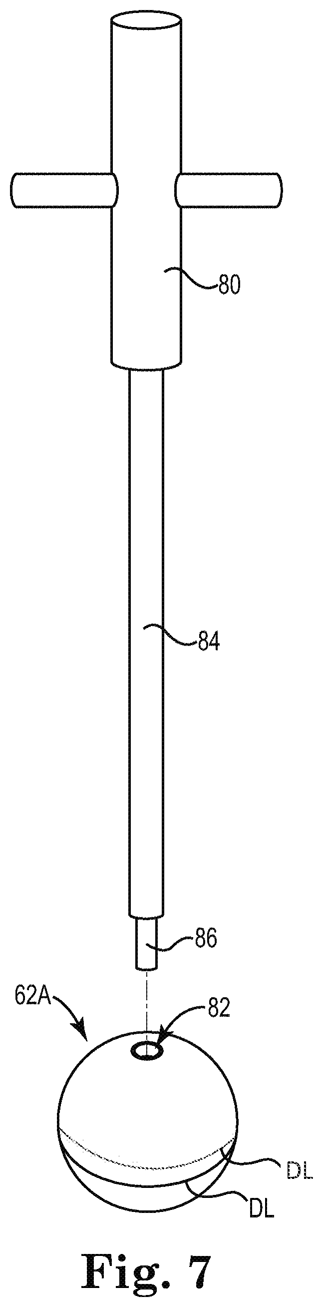 Patent US11771568 Figure 5 – Intra-articular joint replacement and method