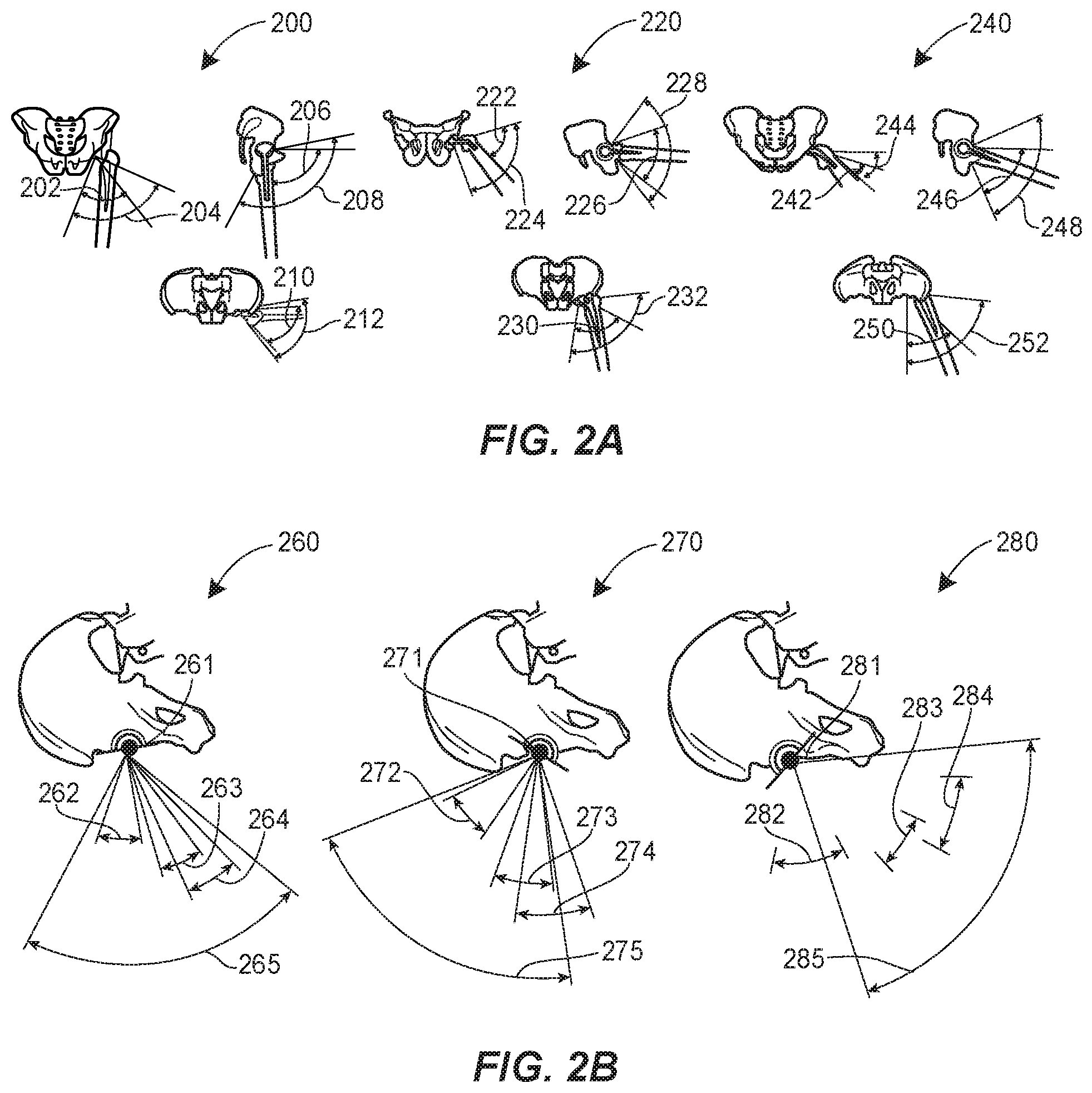 Patent US11771569 Figure 2 – System and method for aligning hip replacement prostheses