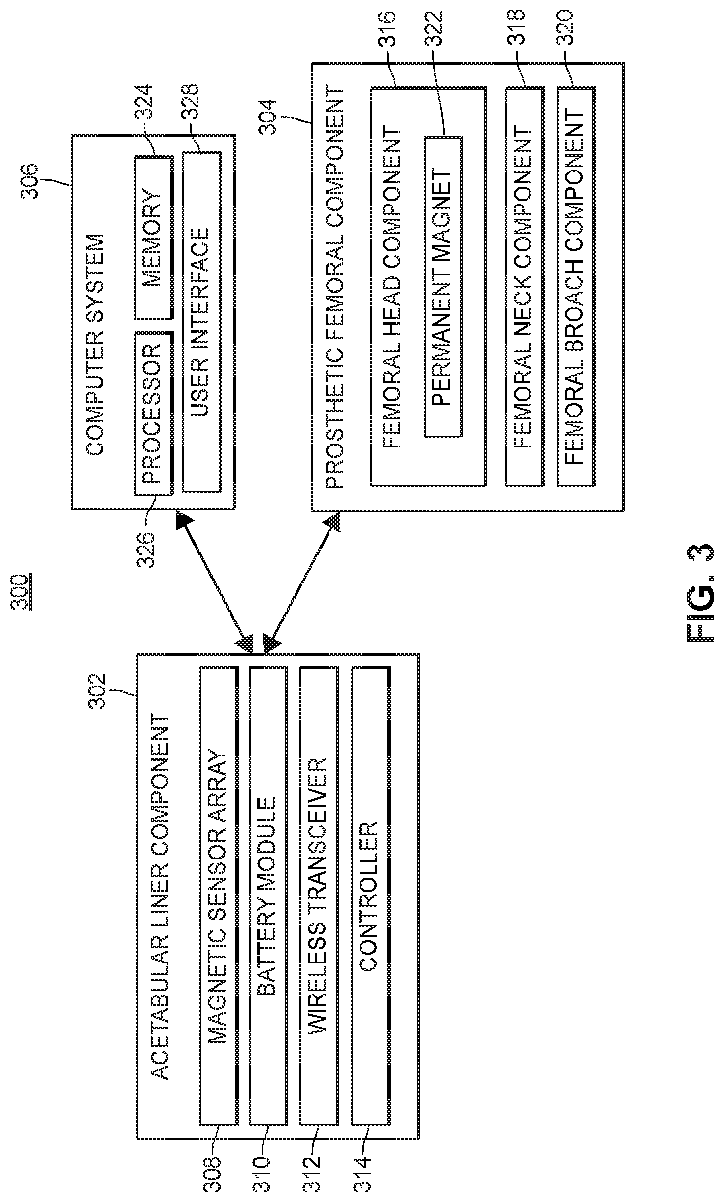 Patent US11771569 Figure 3 – System and method for aligning hip replacement prostheses