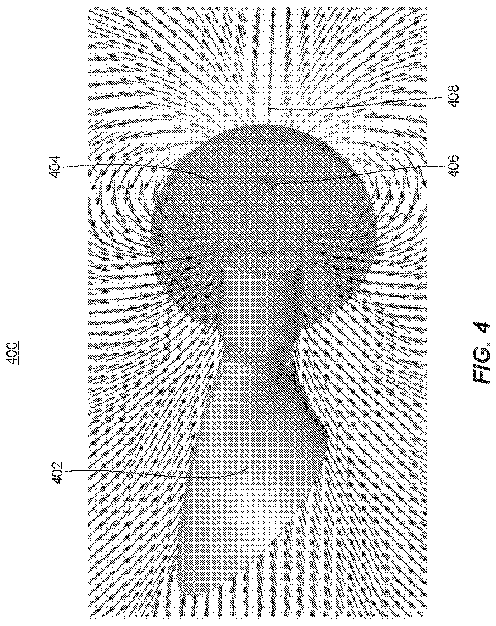 Patent US11771569 Figure 4 – System and method for aligning hip replacement prostheses