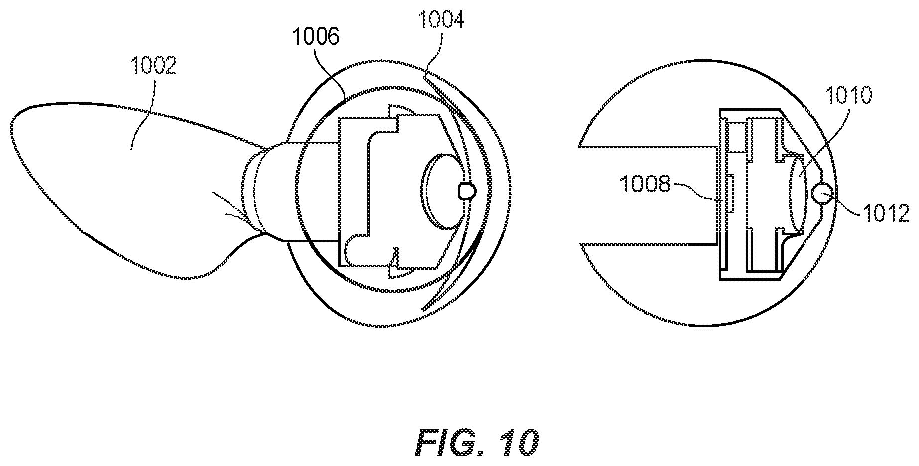 Patent US11771569 Figure 10 – System and method for aligning hip replacement prostheses