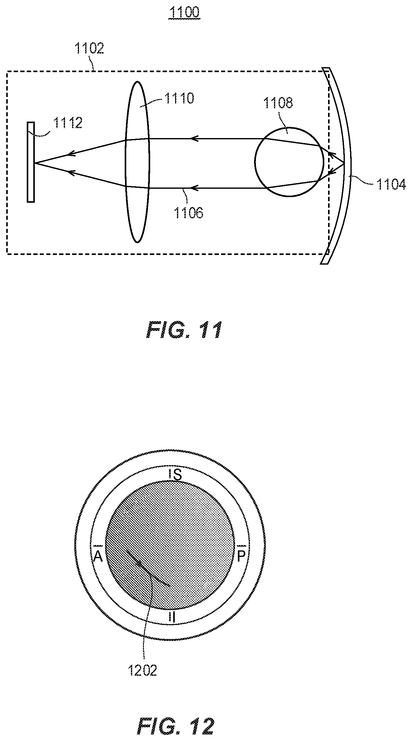 Patent US11771569 Figure 11 – System and method for aligning hip replacement prostheses