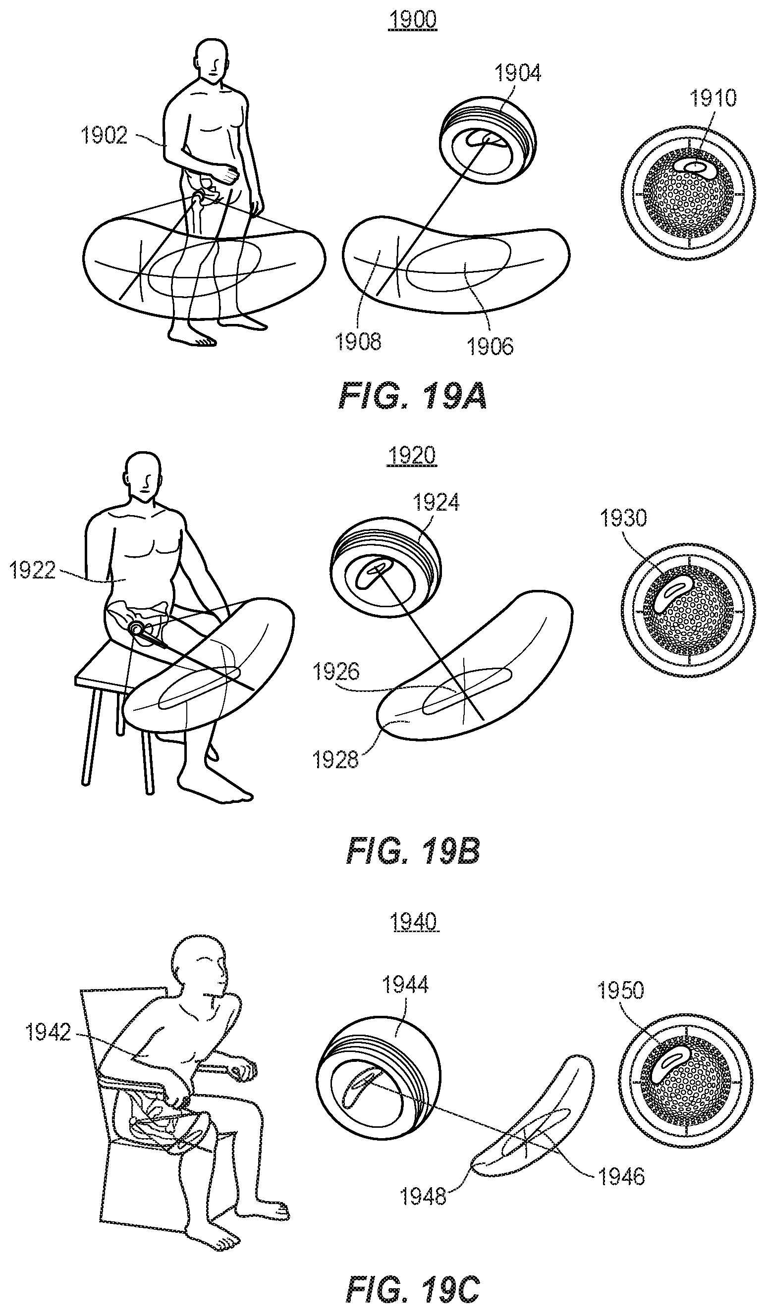 Patent US11771569 Figure 18 – System and method for aligning hip replacement prostheses