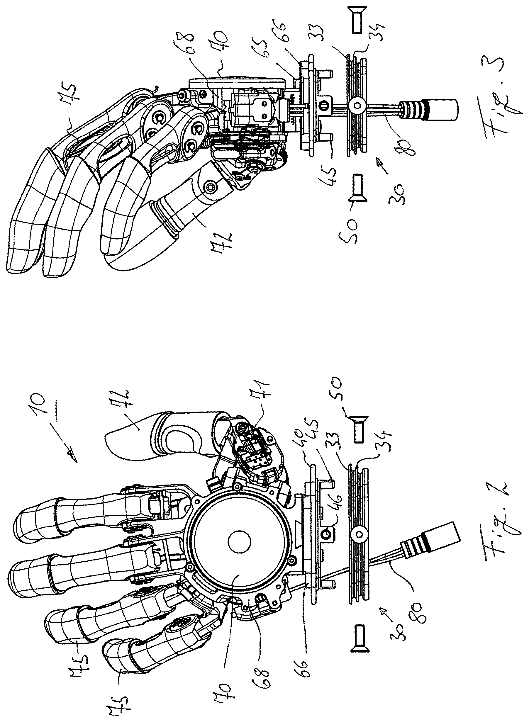 Patent US11771570 Figure 2 – Securing arrangement for a prosthetic hand on a forearm shaft and prosthesis system