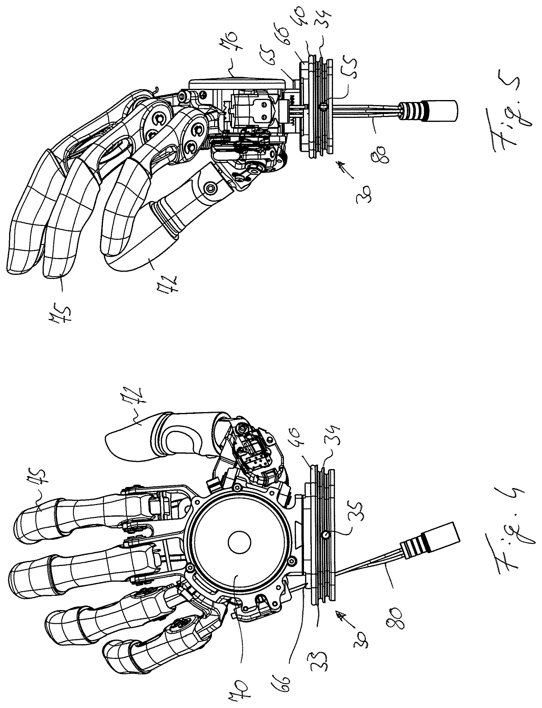 Patent US11771570 Figure 3 – Securing arrangement for a prosthetic hand on a forearm shaft and prosthesis system