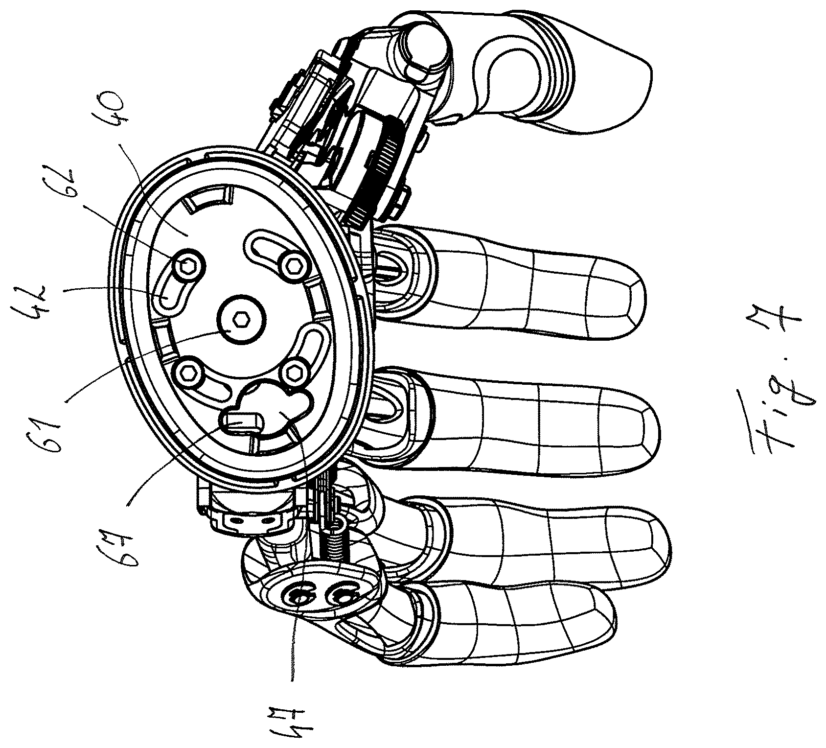 Patent US11771570 Figure 5 – Securing arrangement for a prosthetic hand on a forearm shaft and prosthesis system