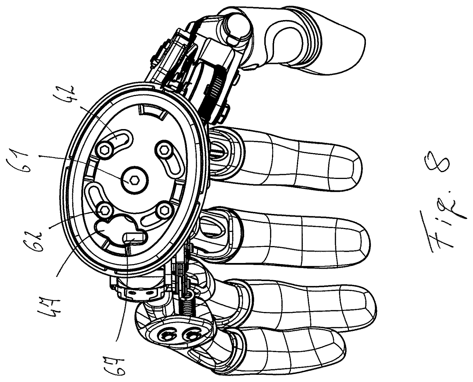 Patent US11771570 Figure 6 – Securing arrangement for a prosthetic hand on a forearm shaft and prosthesis system