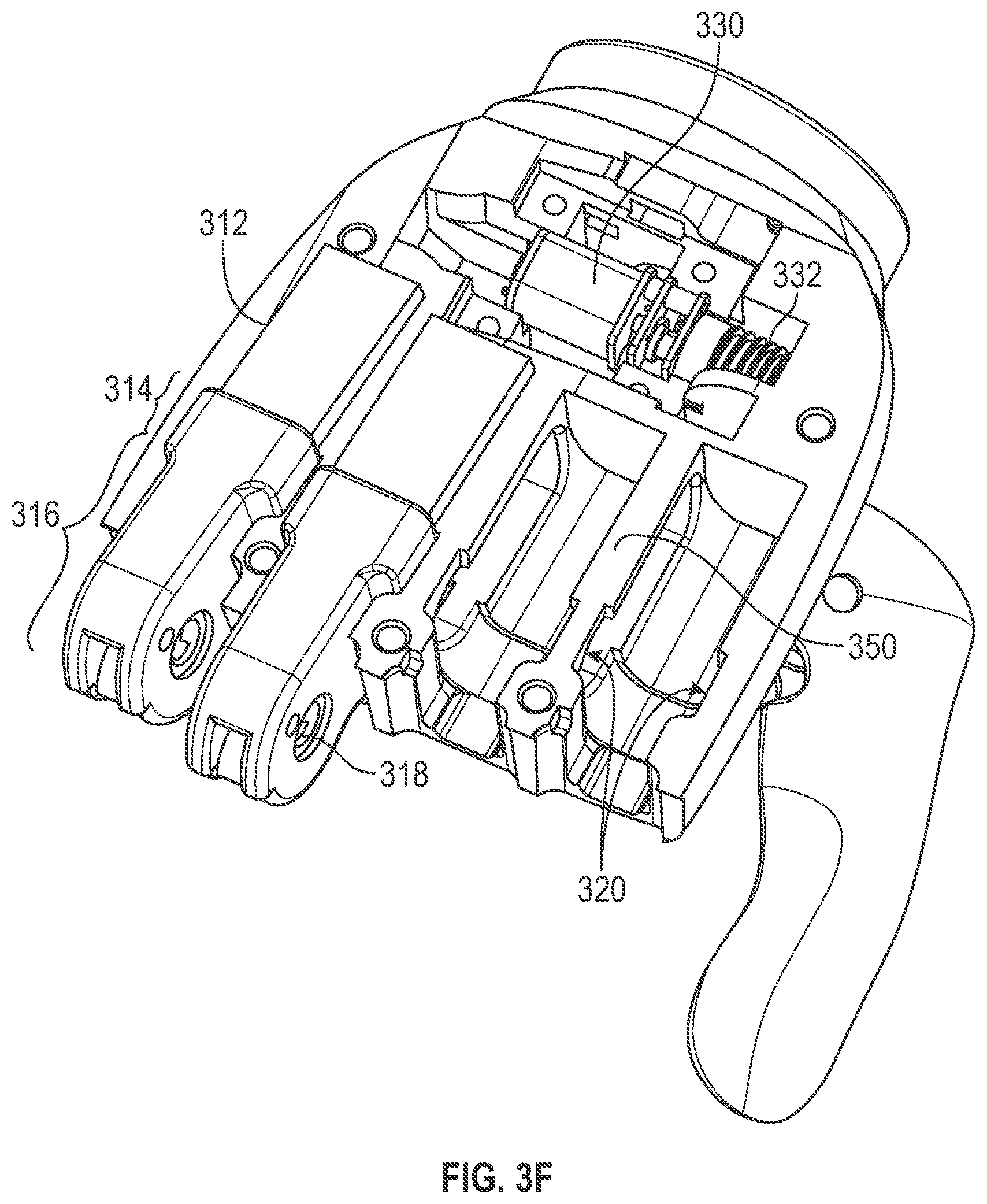 Patent US11771571 Figure 10 – Modular prosthetic hand system