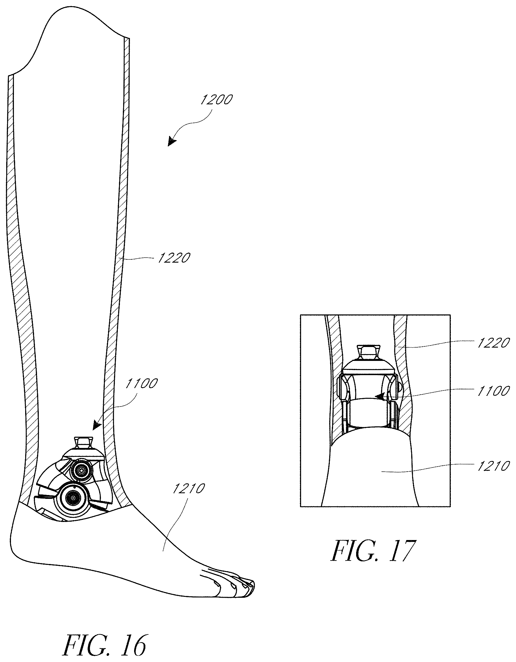 Patent US11771572 Figure 15 – Prosthetic feet having heel height adjustability