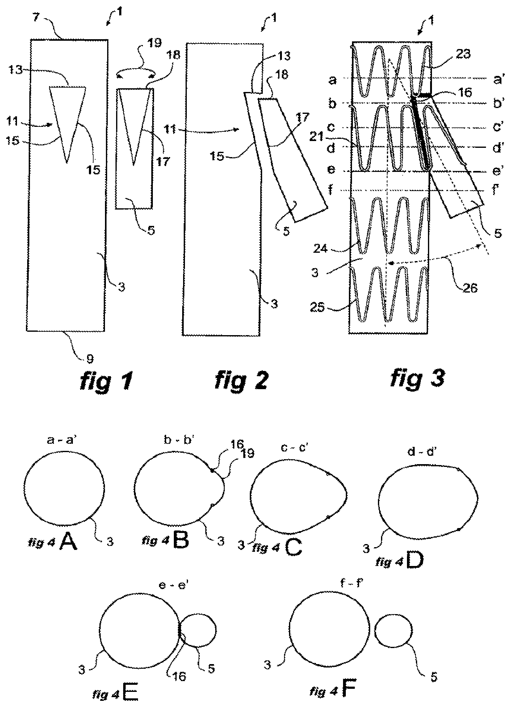 Patent US11771573 Figure 1 – Side branch stent graft